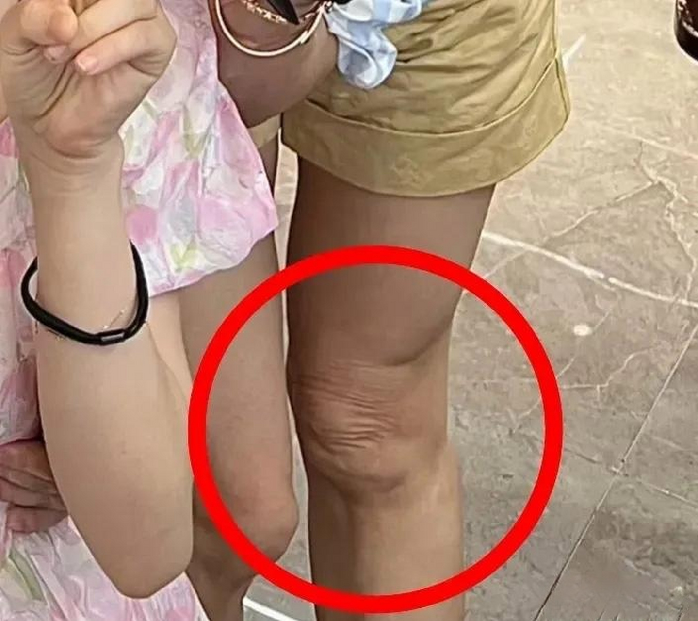 张柏芝的腿直接暴露了年纪