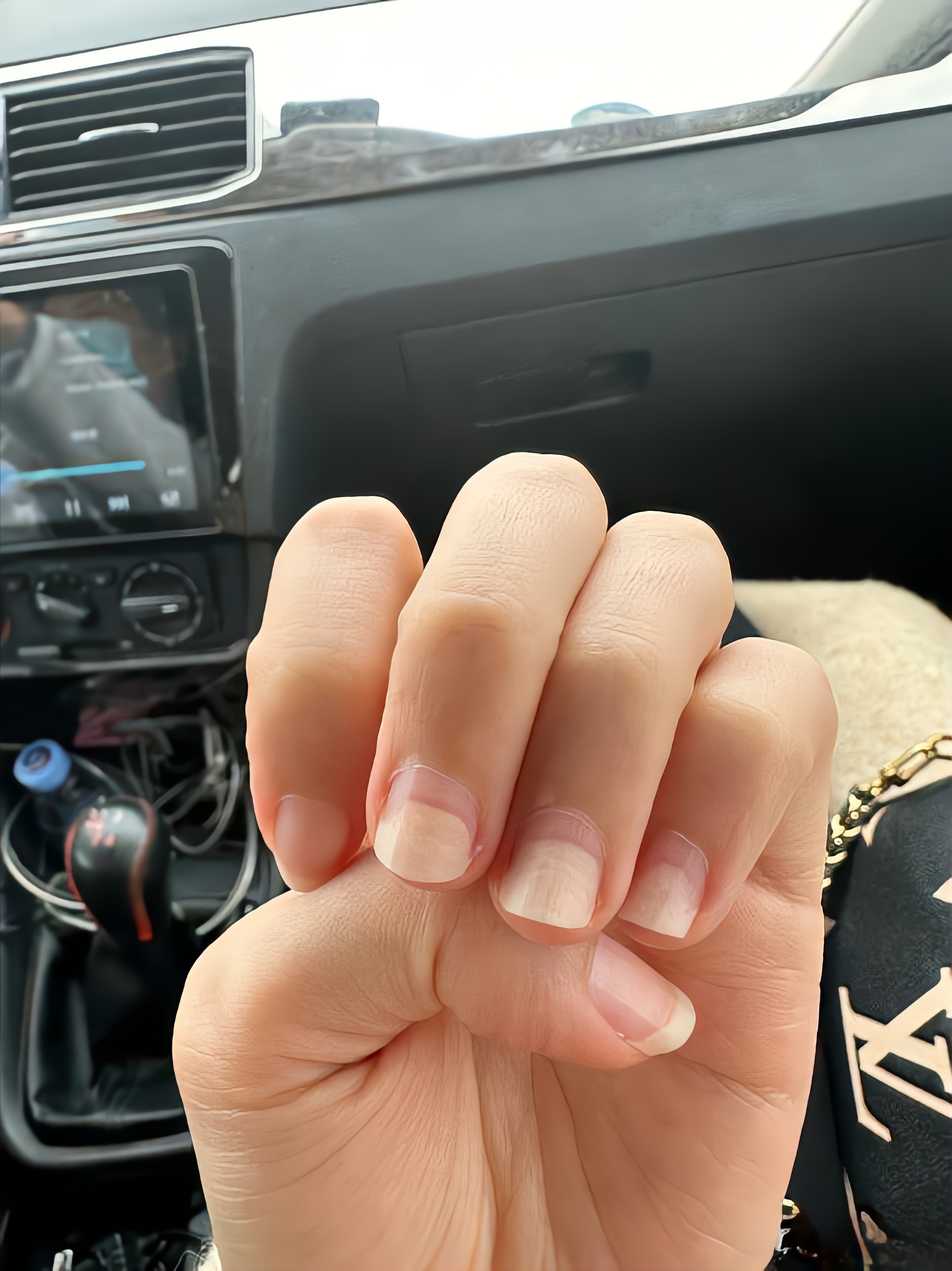 无名指好几年都是空的状态,最近几个月因为 做了指甲,卸完后就中指和