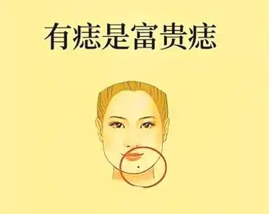 颈部侧面的痣,代表借力得贵;