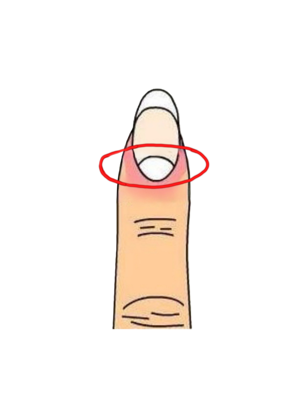 星座# 一,健康状态 正常的手指月牙应当是红润含蓄,坚韧有度,有自然