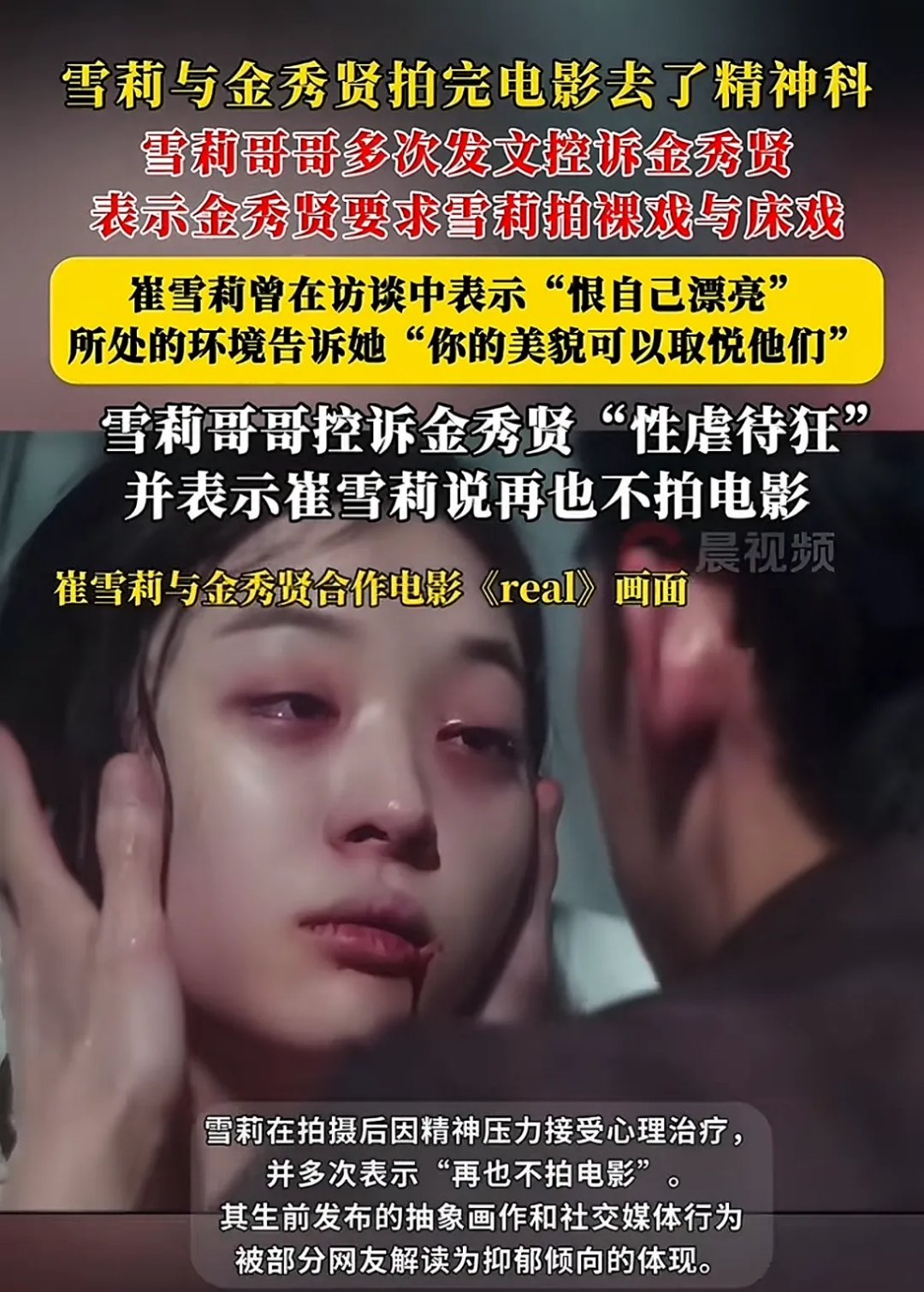 这部剧我那时候看过没打码的非常非常非常震惊我都不敢相信雪莉会