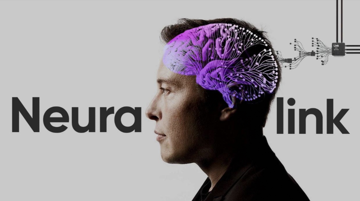 在成都创未来丨工信部未来产业“揭榜挂帅”单位“成都造”用脑机接口技术造福孤独症儿童(图1)