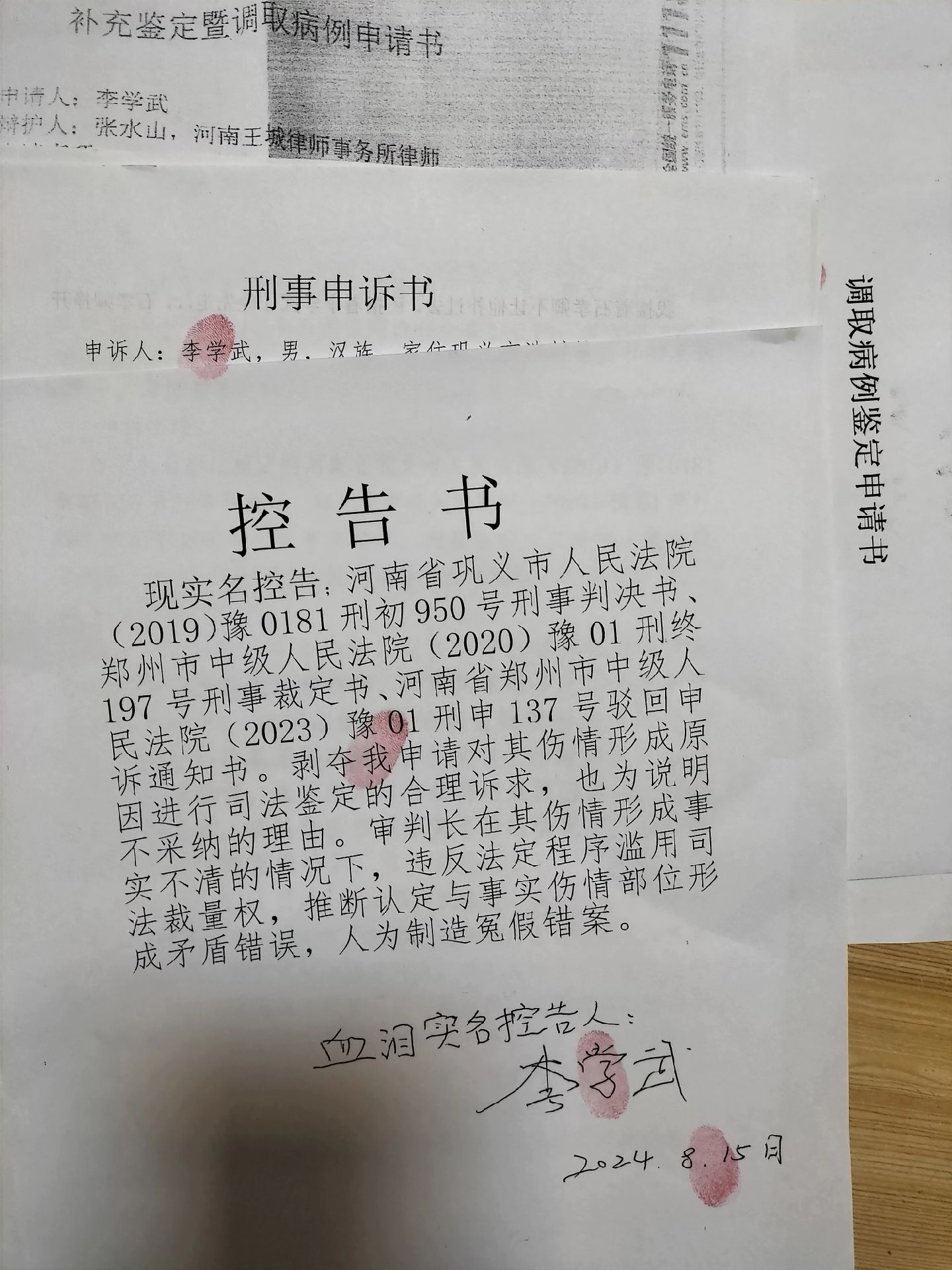 我面对不法侵害勇于反抗,却被法官无理由剥夺我对其