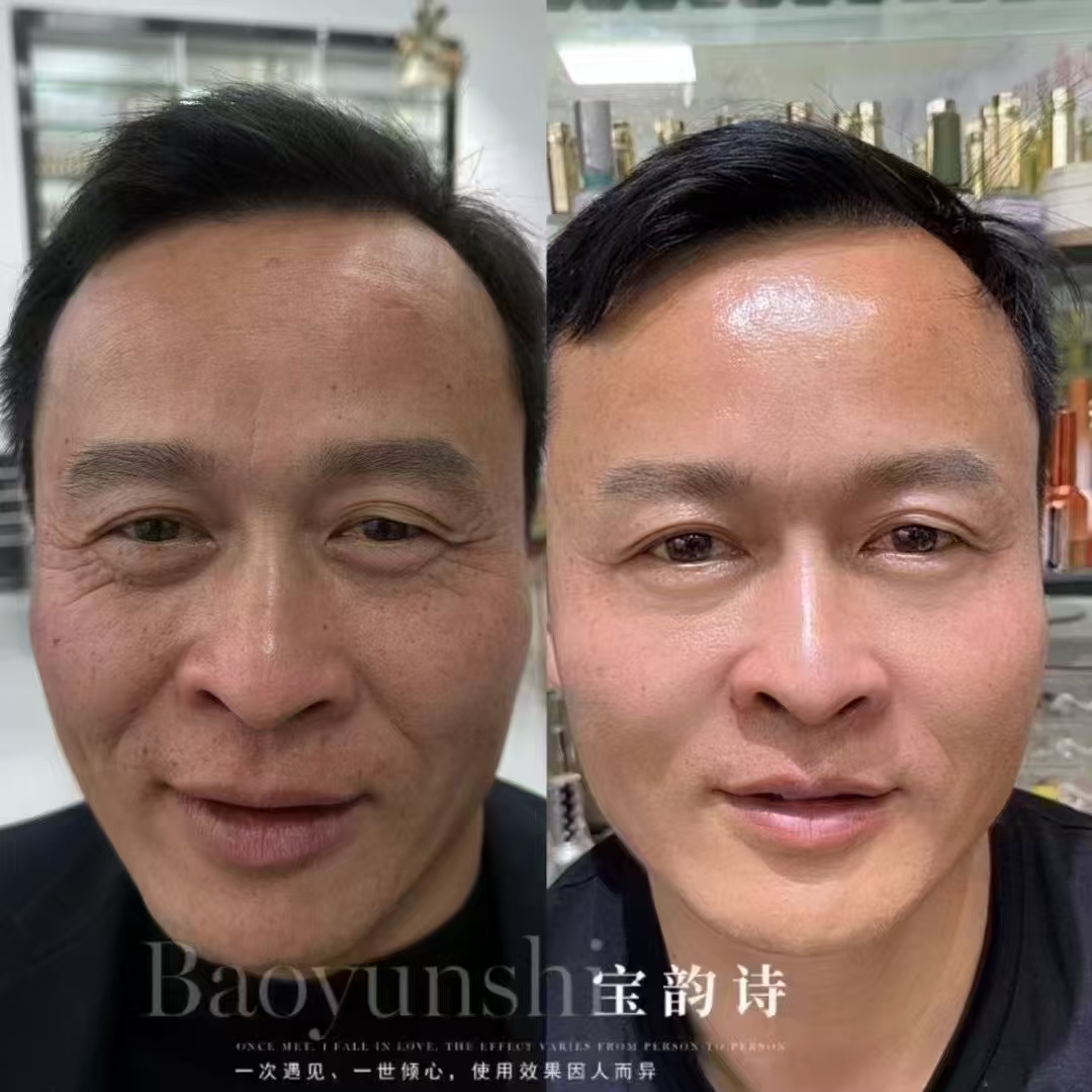 这个年代,不光是女人需要保养了,男人也需要保养 卖