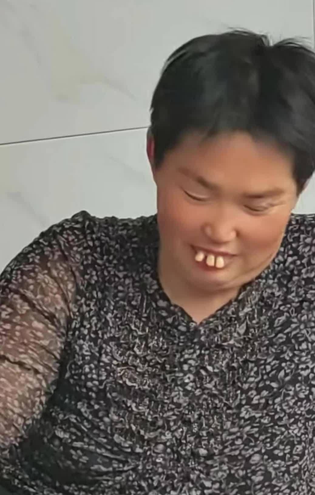 这个大姐的三个龅牙好明显啊[跪了]她怎么没去做个整形牙齿的,第一眼