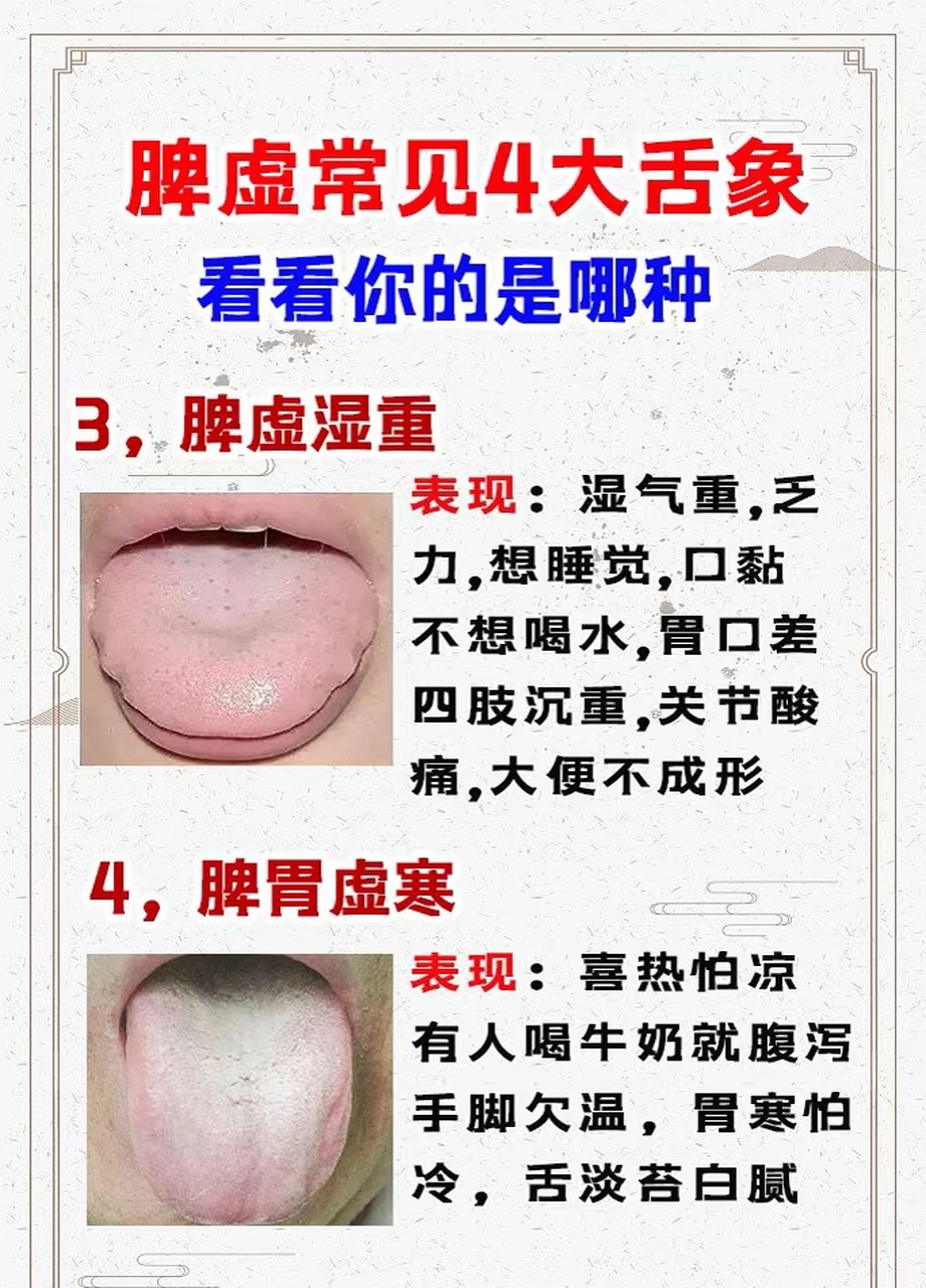 脾胃虚弱常见四大舌象!