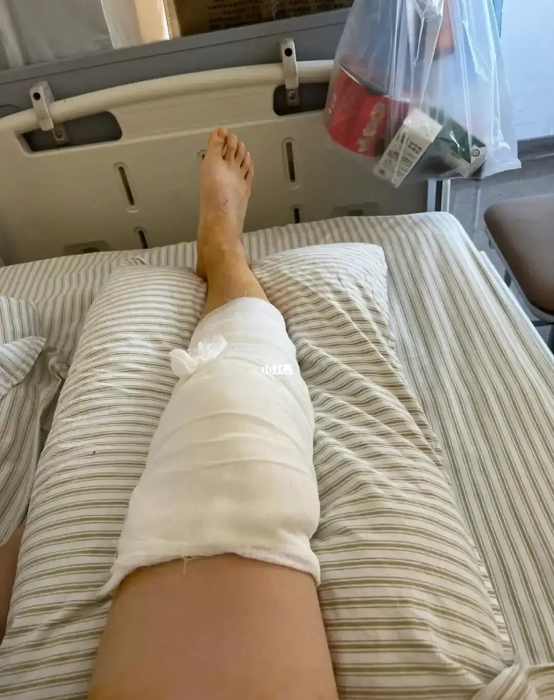 同学的父亲遭遇车祸,大腿粉碎性骨折,已在医院住院十余天,手术和治疗