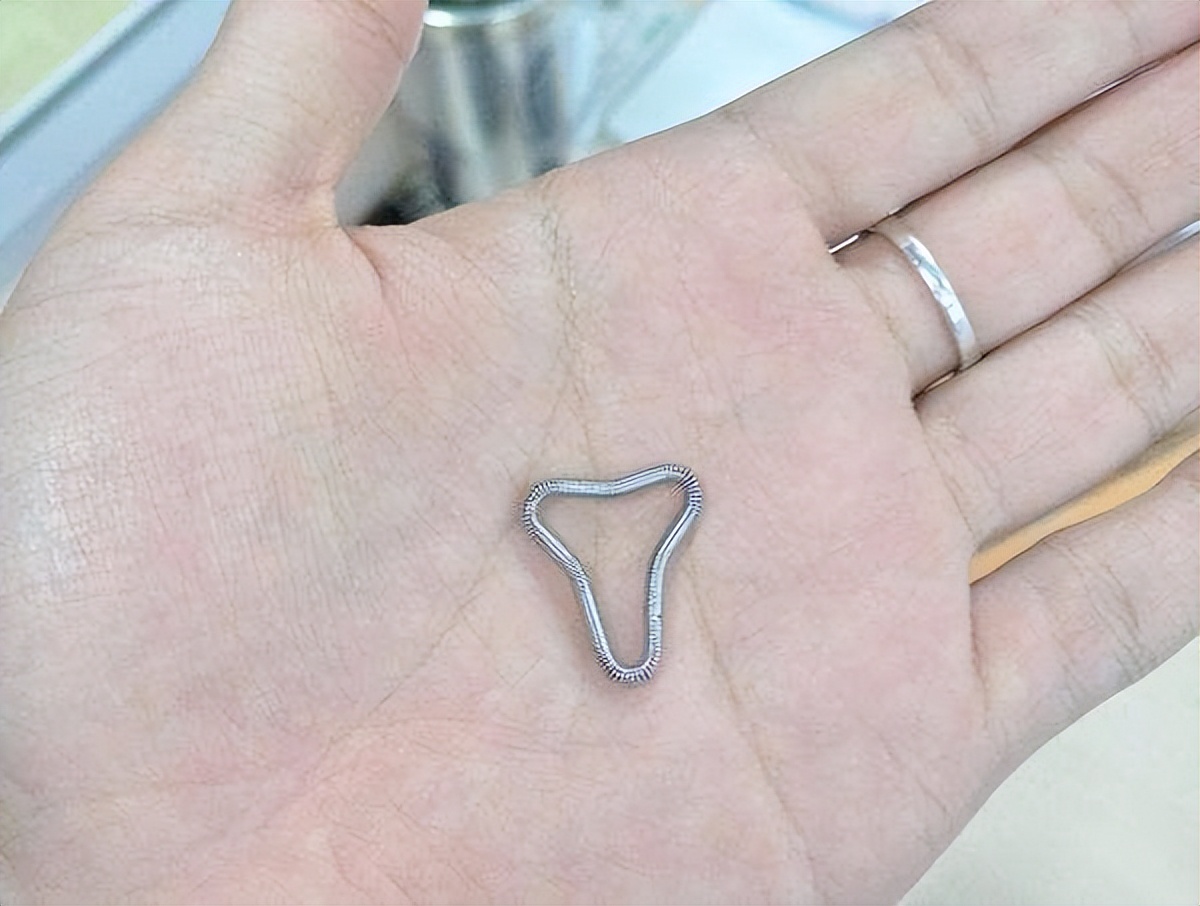 我一同学今年54岁了,说出来可能许多人都不会相信,同学的节育环在身体