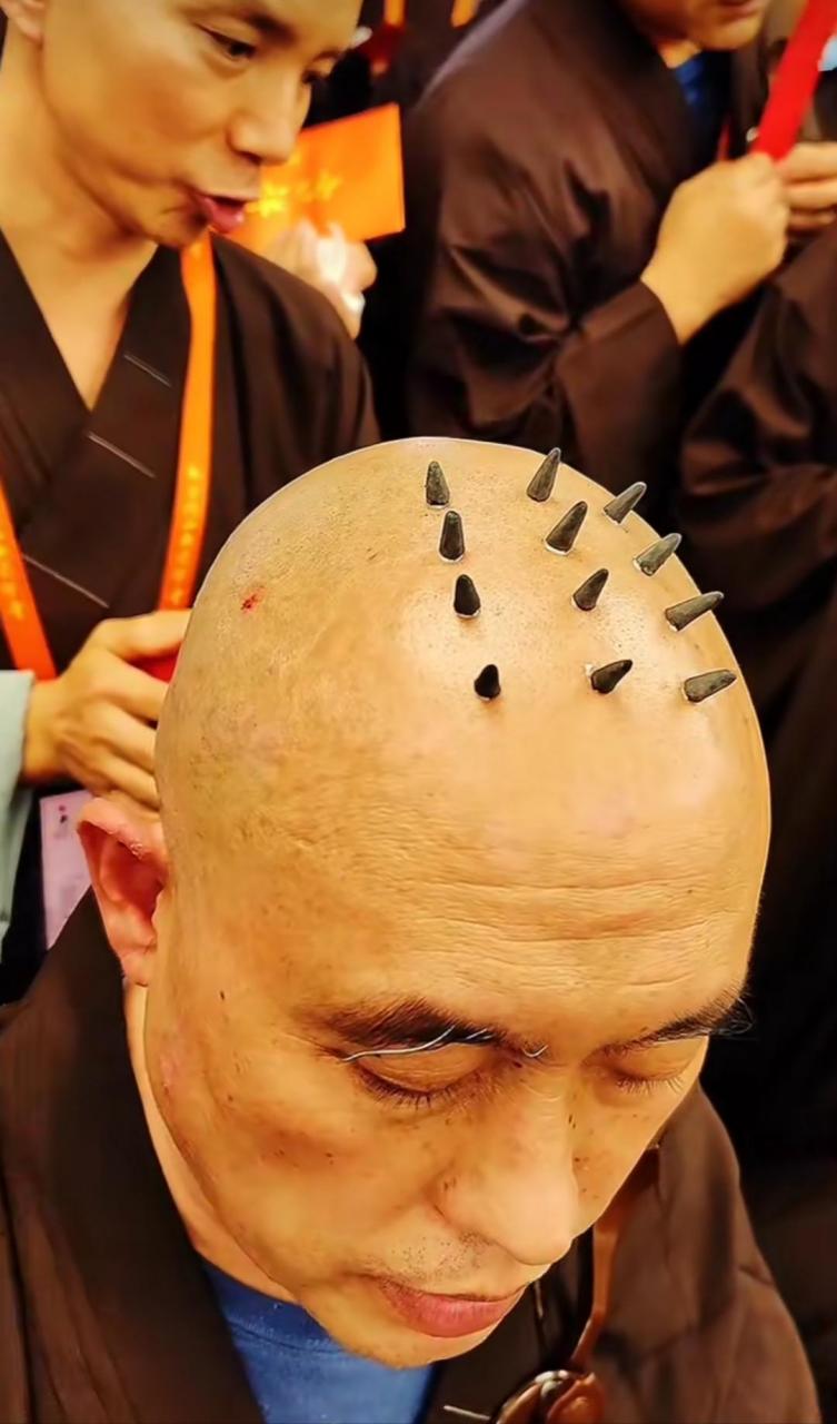 原来是这么点出来的,不知道疼不疼?