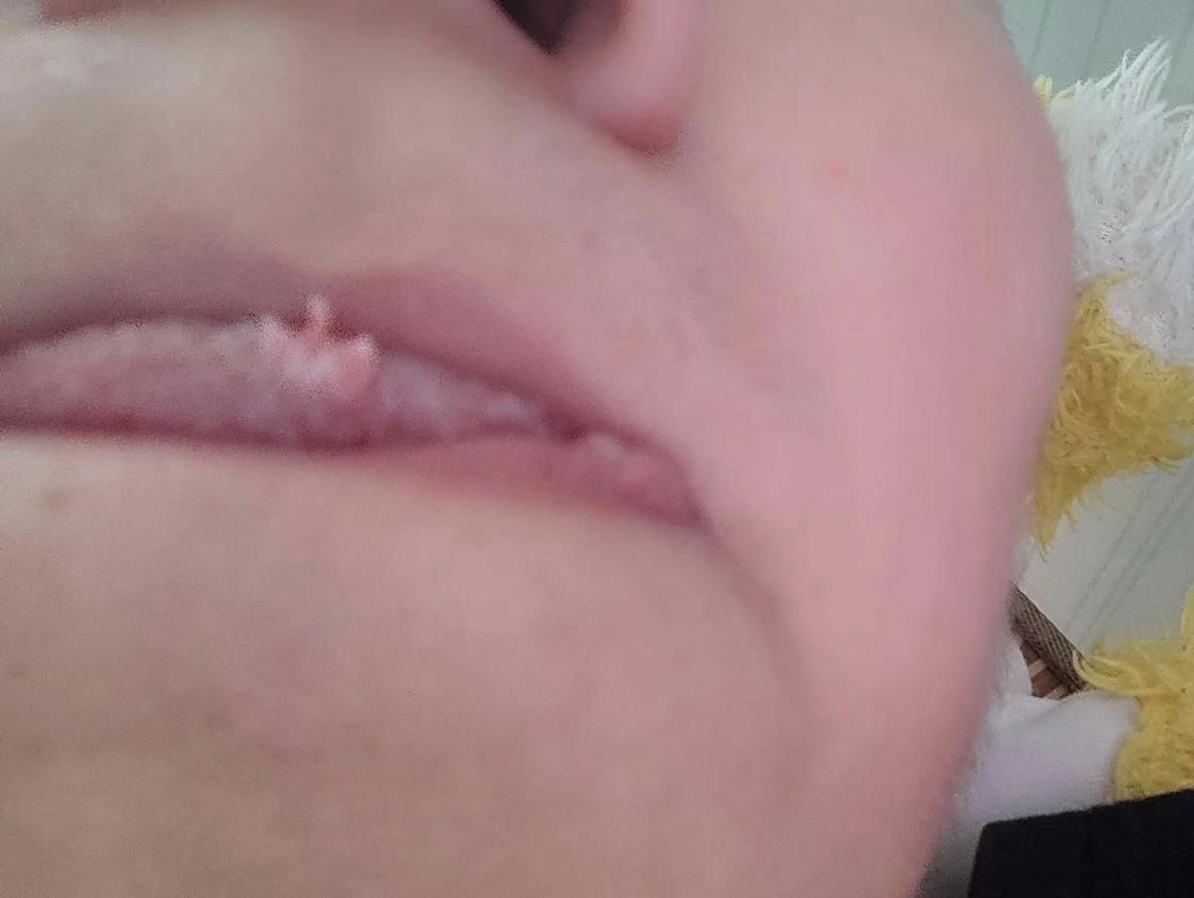 最近舌头长了个菜花一样的东西,有谁知道这是啥?要不要去医院看看