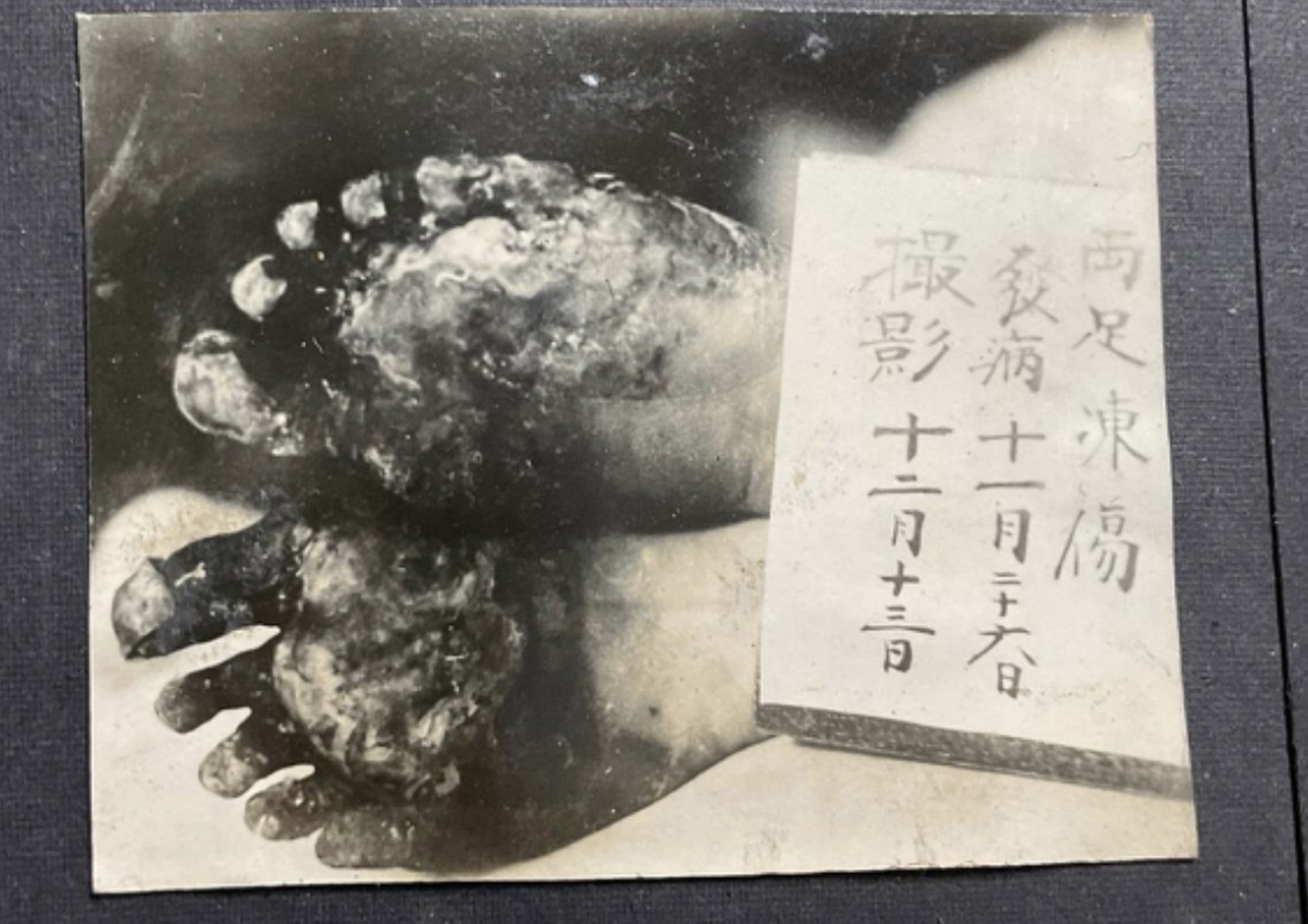 罕见伪满时期日军731部队研究人体细菌实验旧照