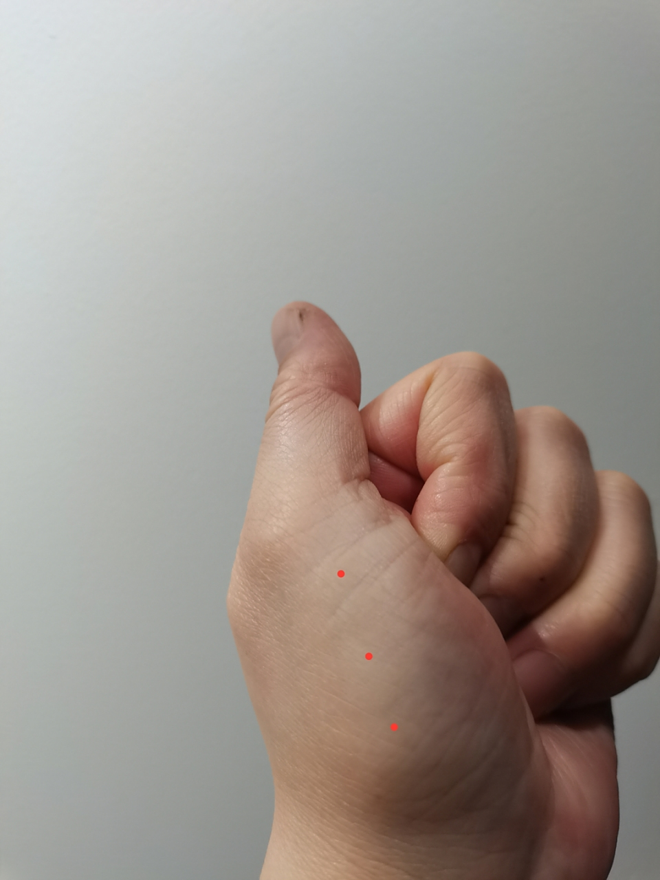 神奇的董氏针灸,土水穴.