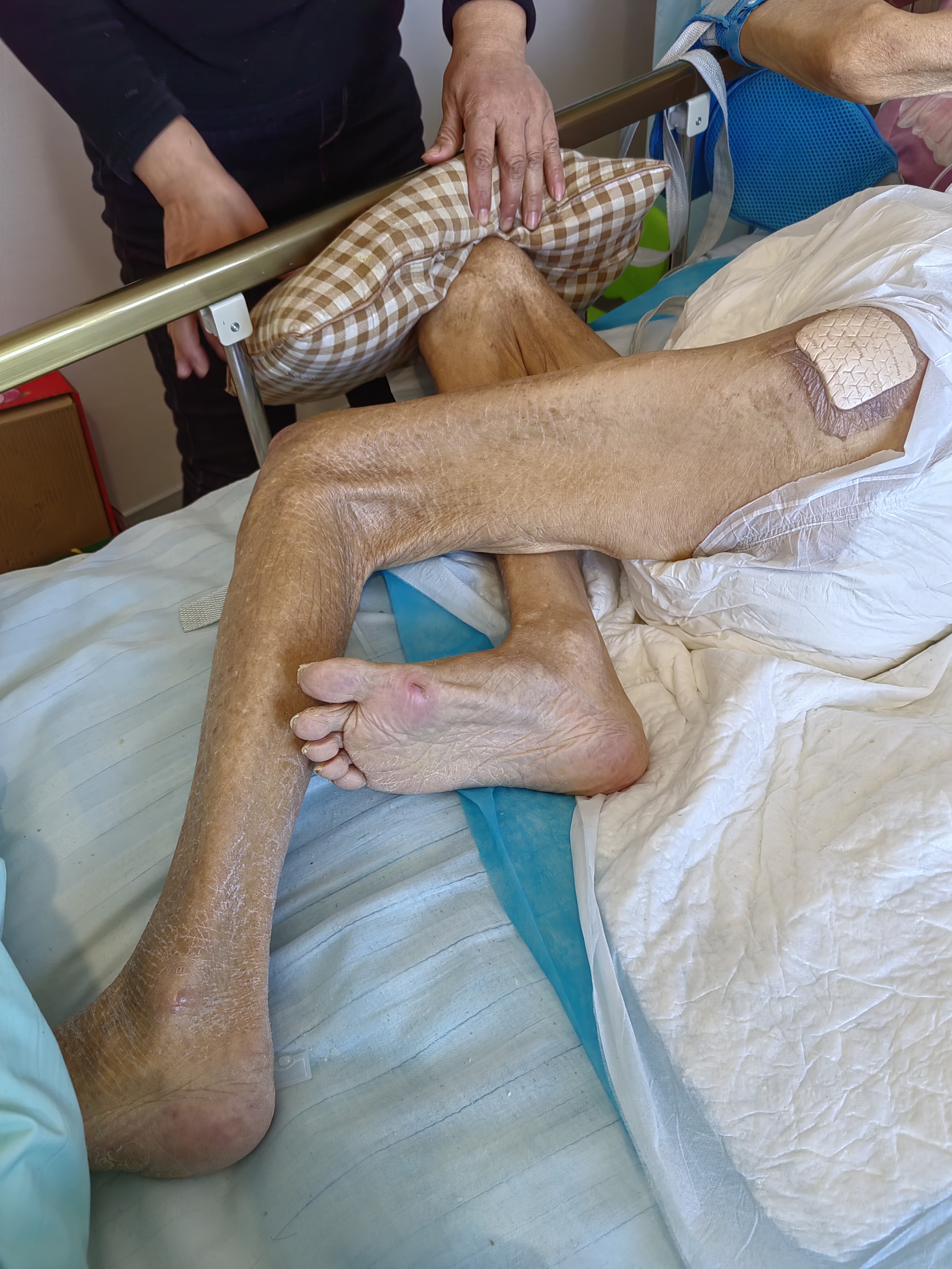 银河年华医养中心,老年公寓院长卢桂花,主任马丽,不负责任,苛待老人