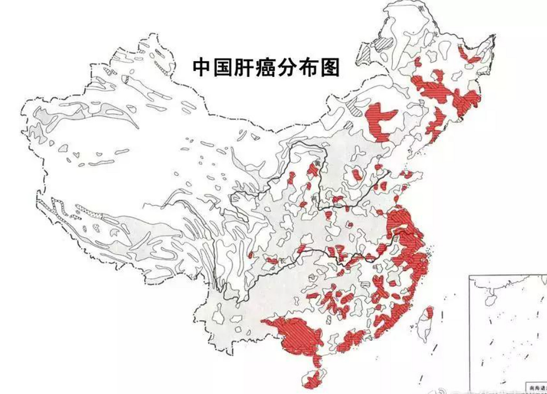 【中国肝癌高发地区地图】 原发性肝癌高发地区主要有两种情况:1,气候