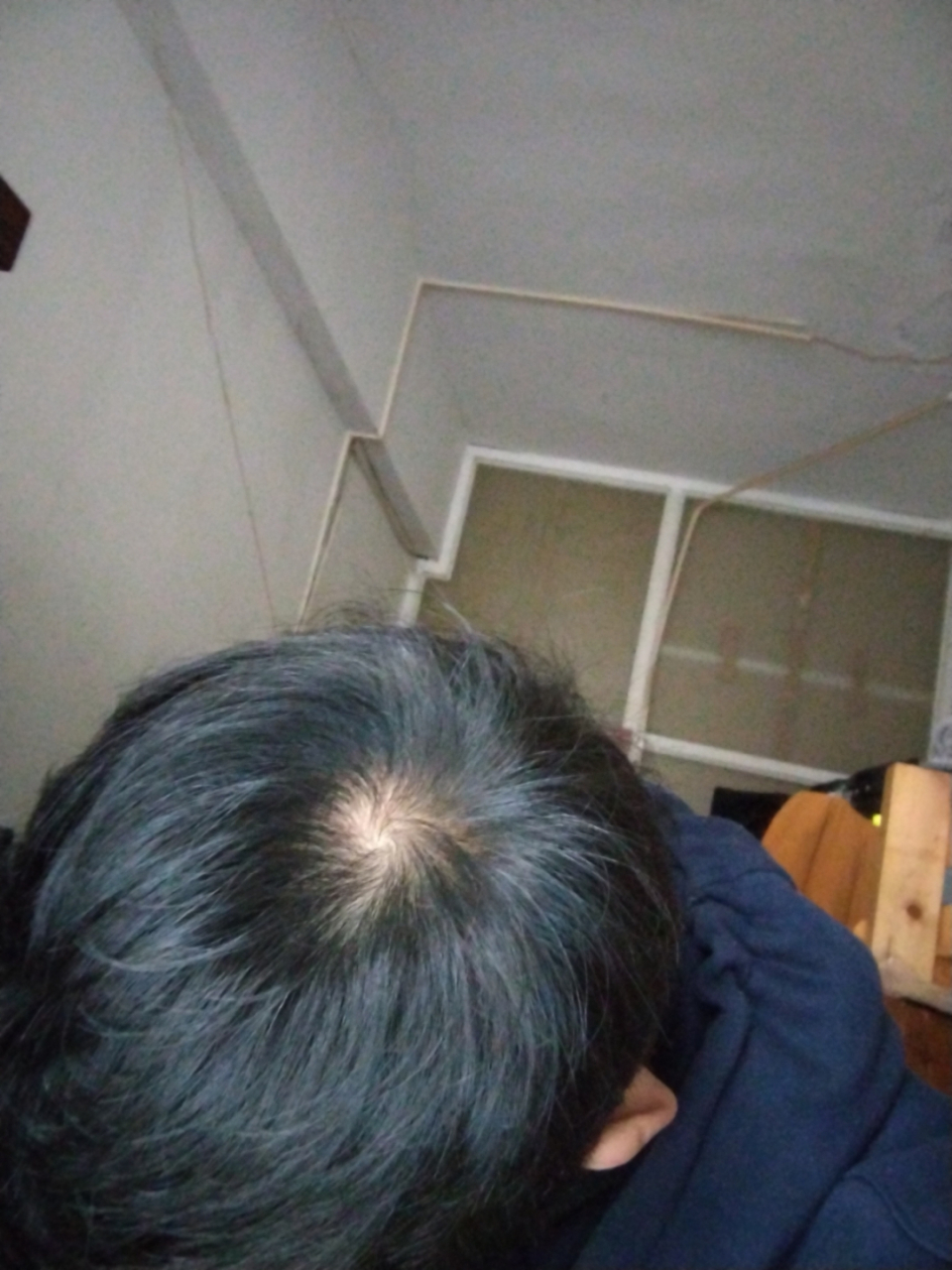 这是不是秃顶的前兆啊?心好慌!