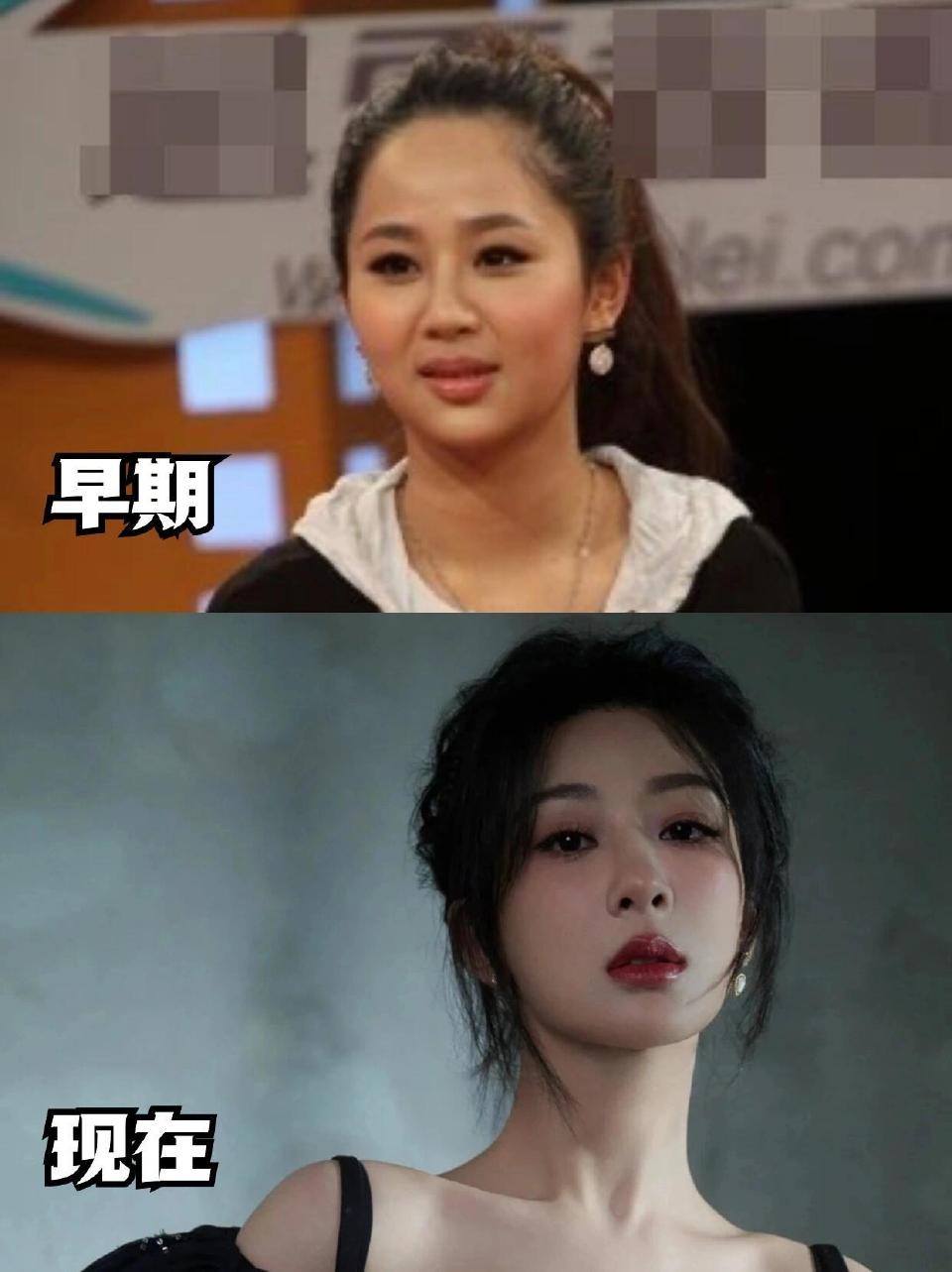 杨紫整容=杨紫整容现在是不是整过头了