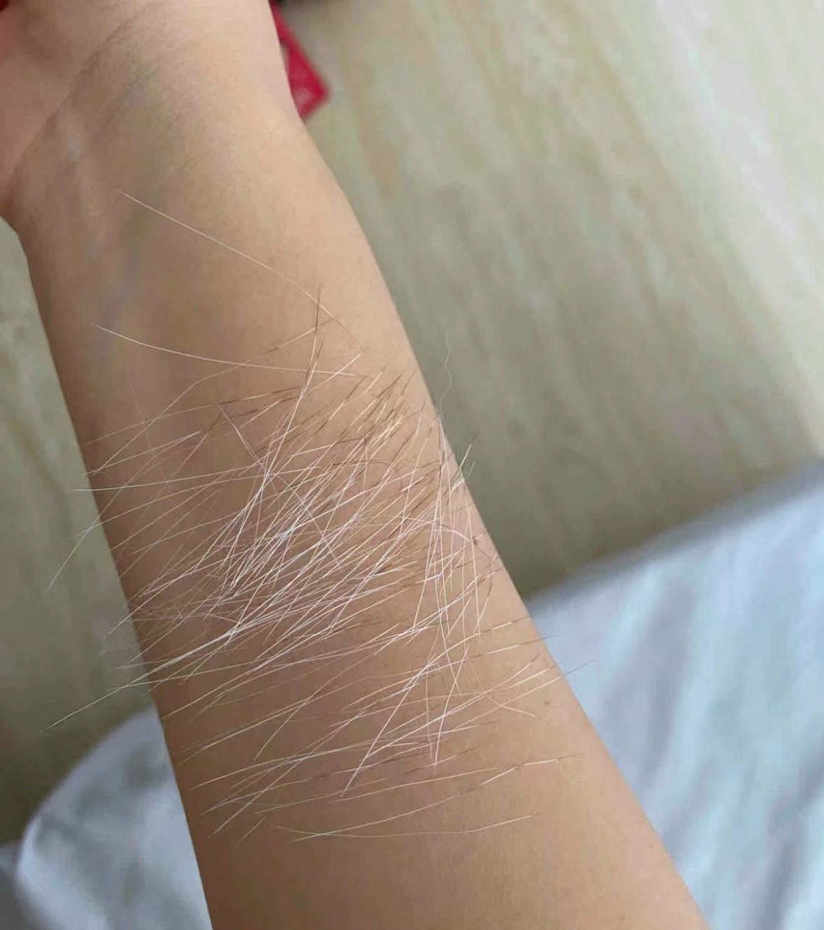 你是否见过手臂上有着如此惊人的景象