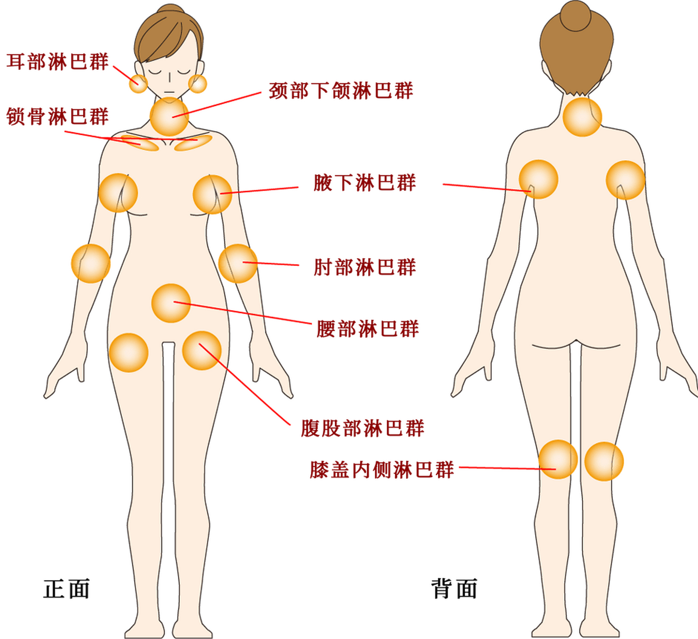 淋巴瘤 一个健康人体内大约有一百亿个淋巴,它遍布全身,其中有8个