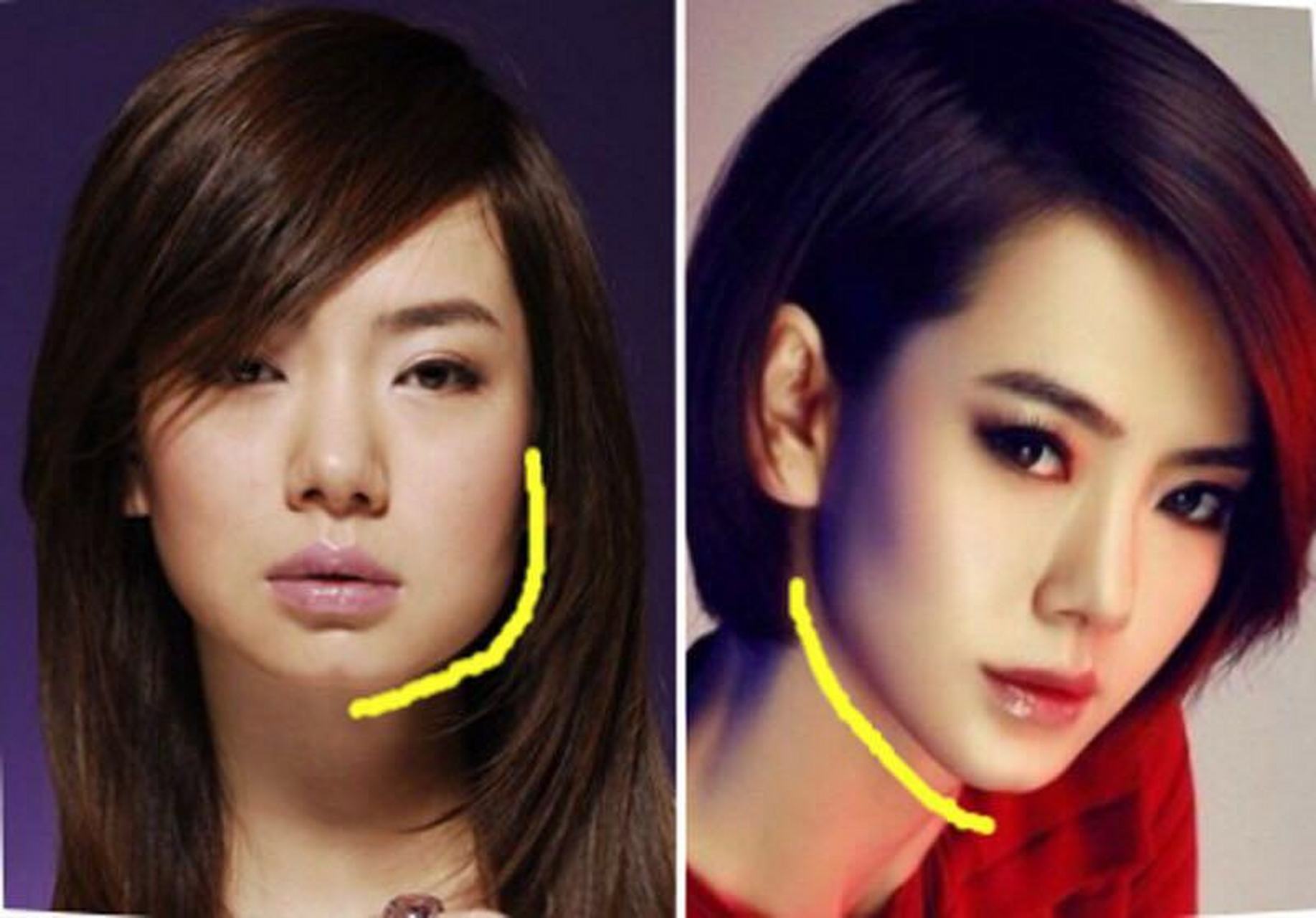 不知大家有没有发现,以前去整容的大都是明星,歌星,网红,他们的长相