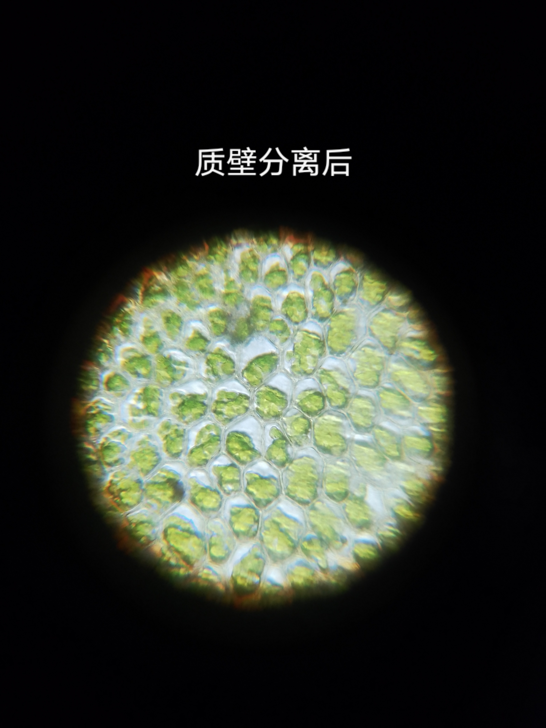 苔藓细胞加氯化钠溶液质壁分离前后对比