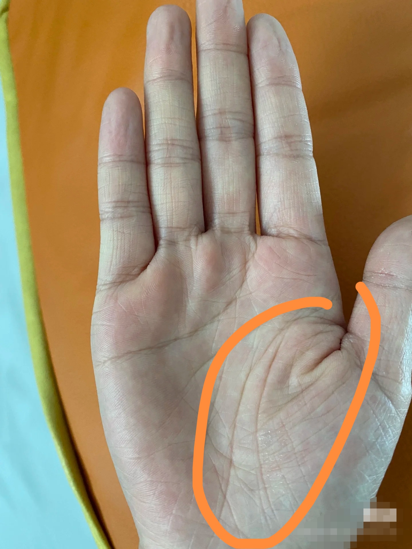 双重生命线,生命力顽强,逢凶化吉,有祖荫庇护,蛮不错的