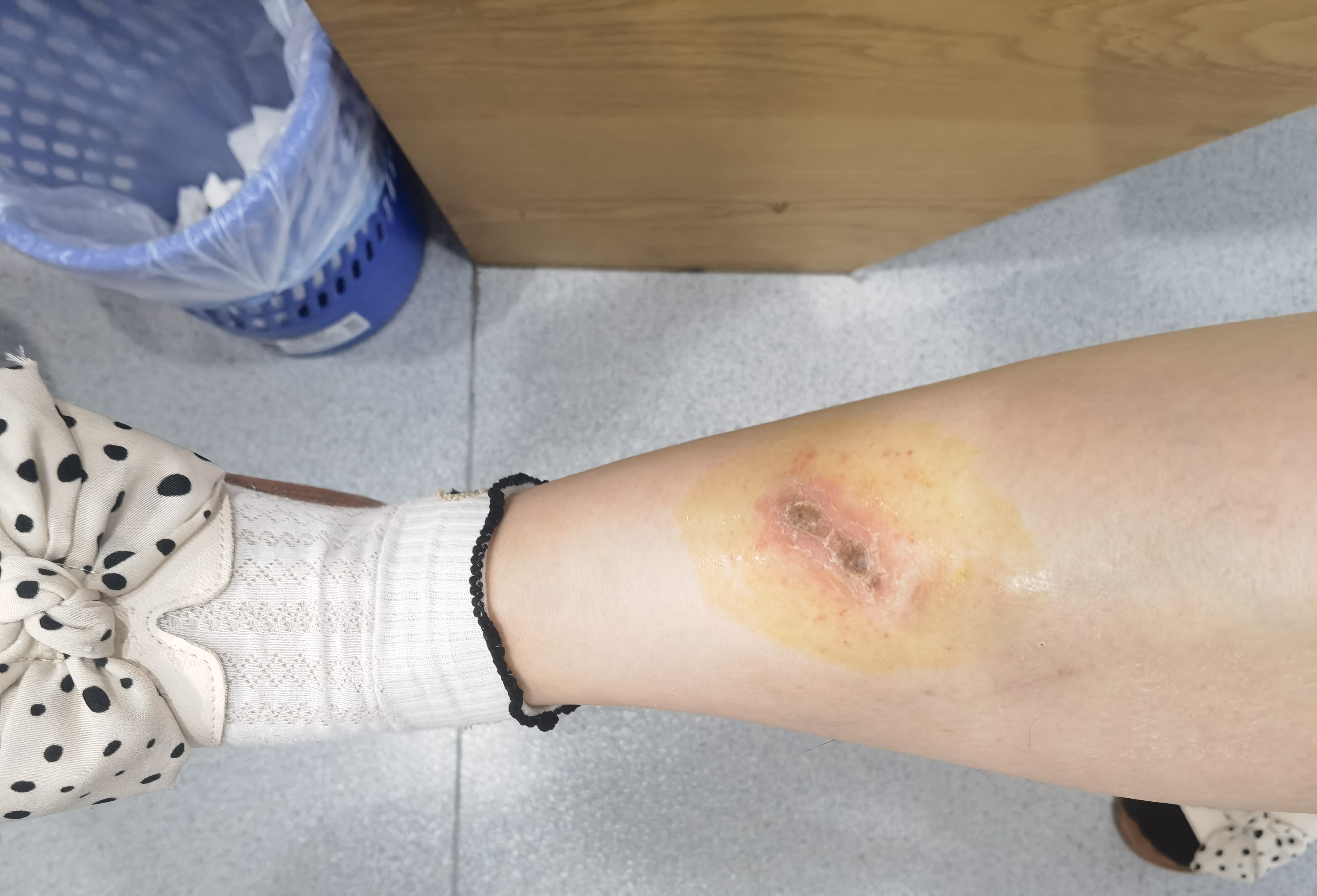 新伤旧痕,又添一道朱砂记.不是去医院就是去医院的路上