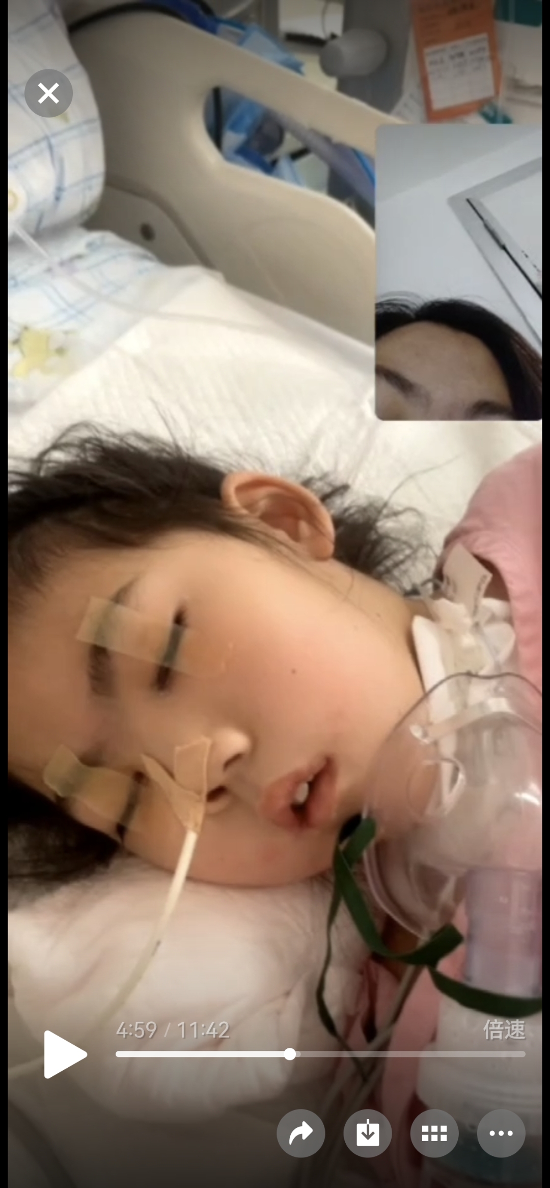 三甲医院监控说法三连变# 9岁女孩成植物人真相被掩盖?