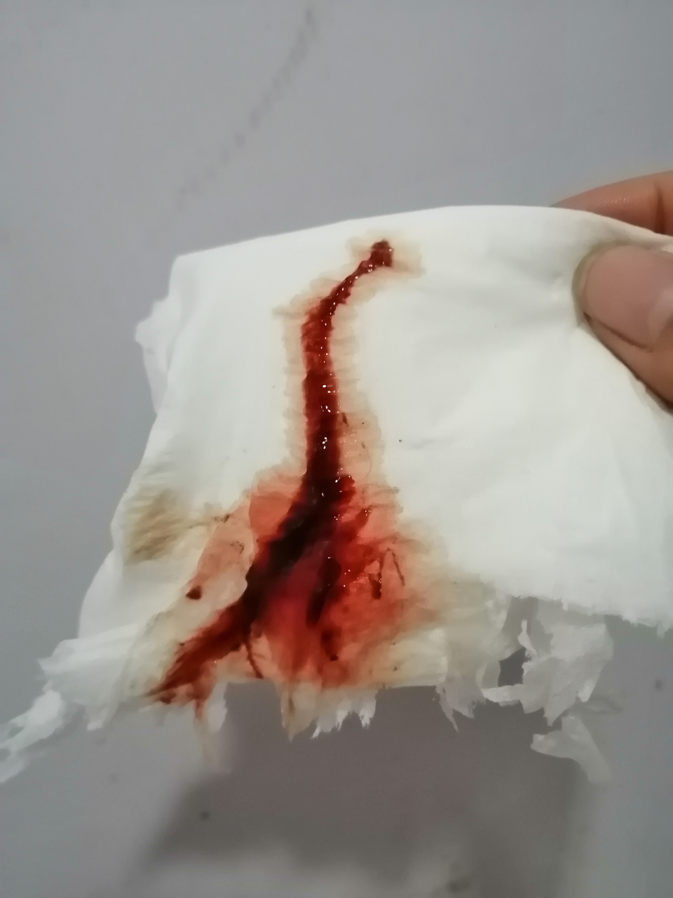姨妈血有类似肠子一样的东西=姨妈血有类似肠子一样的东西怎么回事