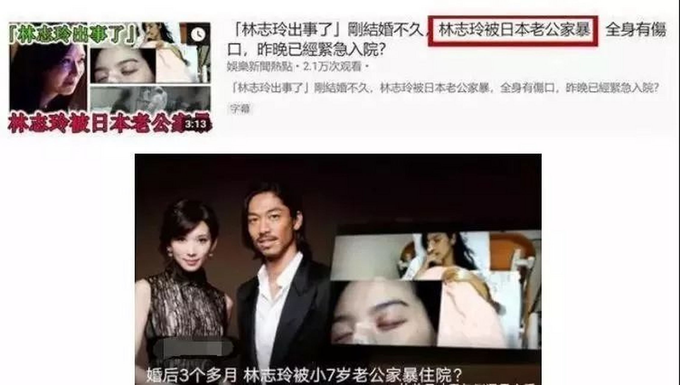 中国蒋劲夫家暴日本妻子被封杀,日本黑泽良平家暴中国妻子林志玲安然