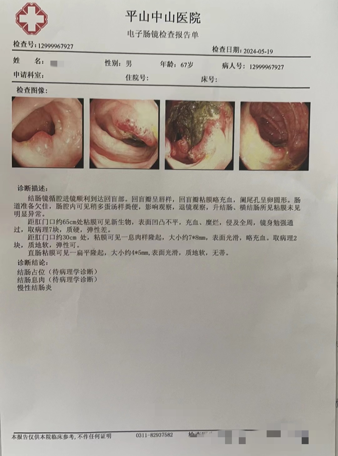 肠镜正常结果图片图片