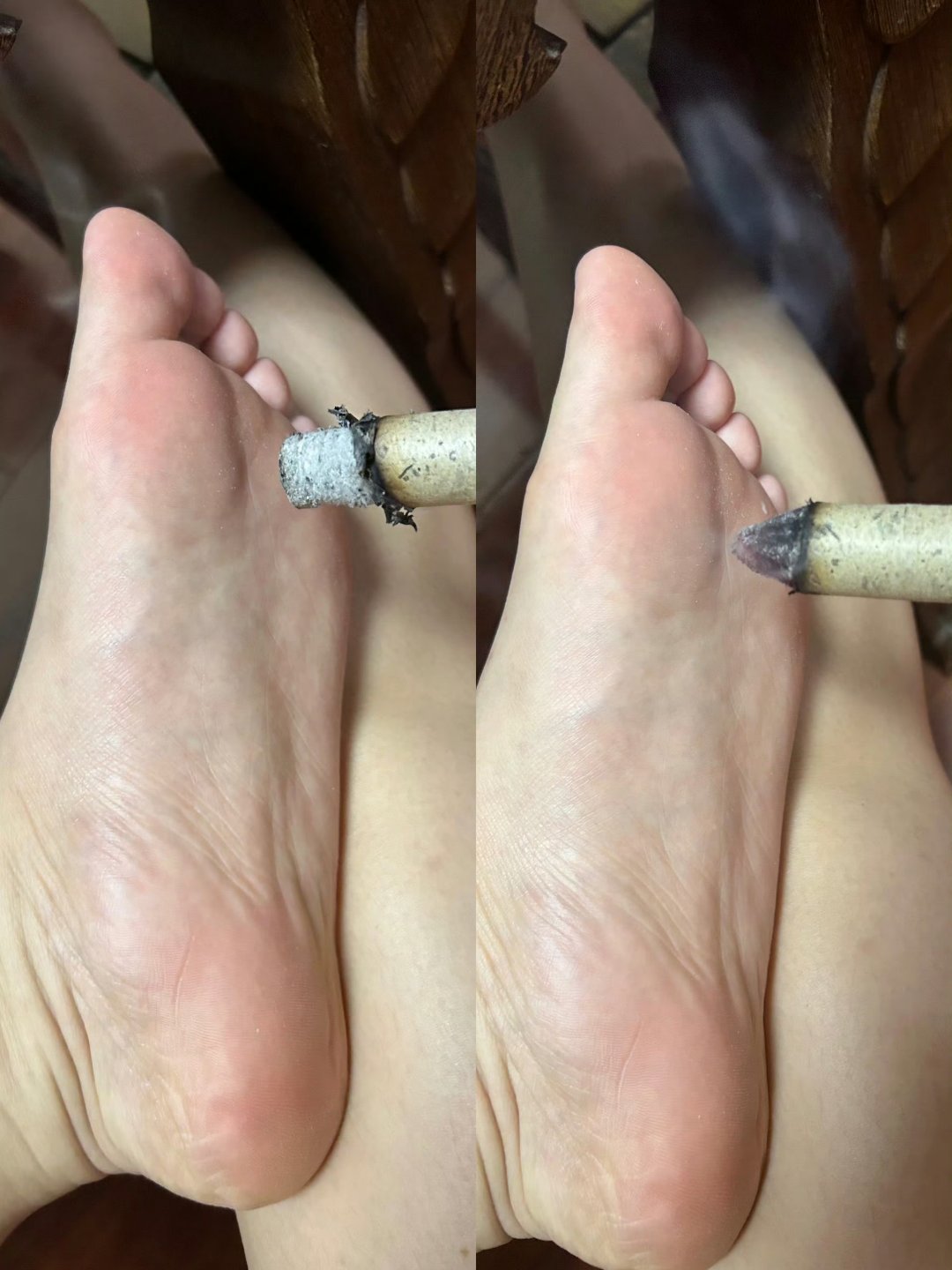 "为什么我艾灸后反应不明显呢?