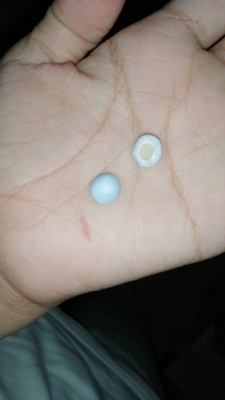 有谁知道虾壳里面弄出来的浅蓝色的小石头是什么吗?