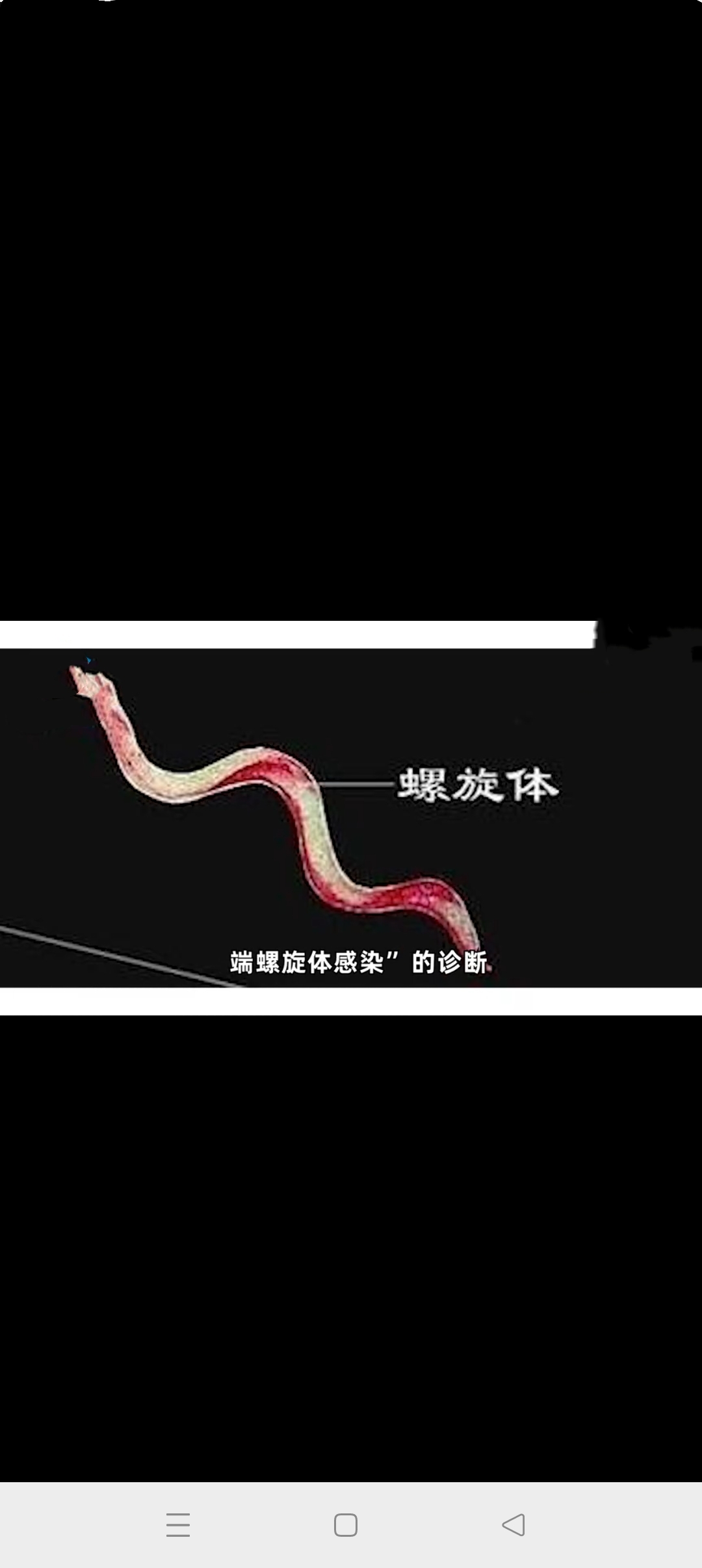 钩虫丝状蚴图片