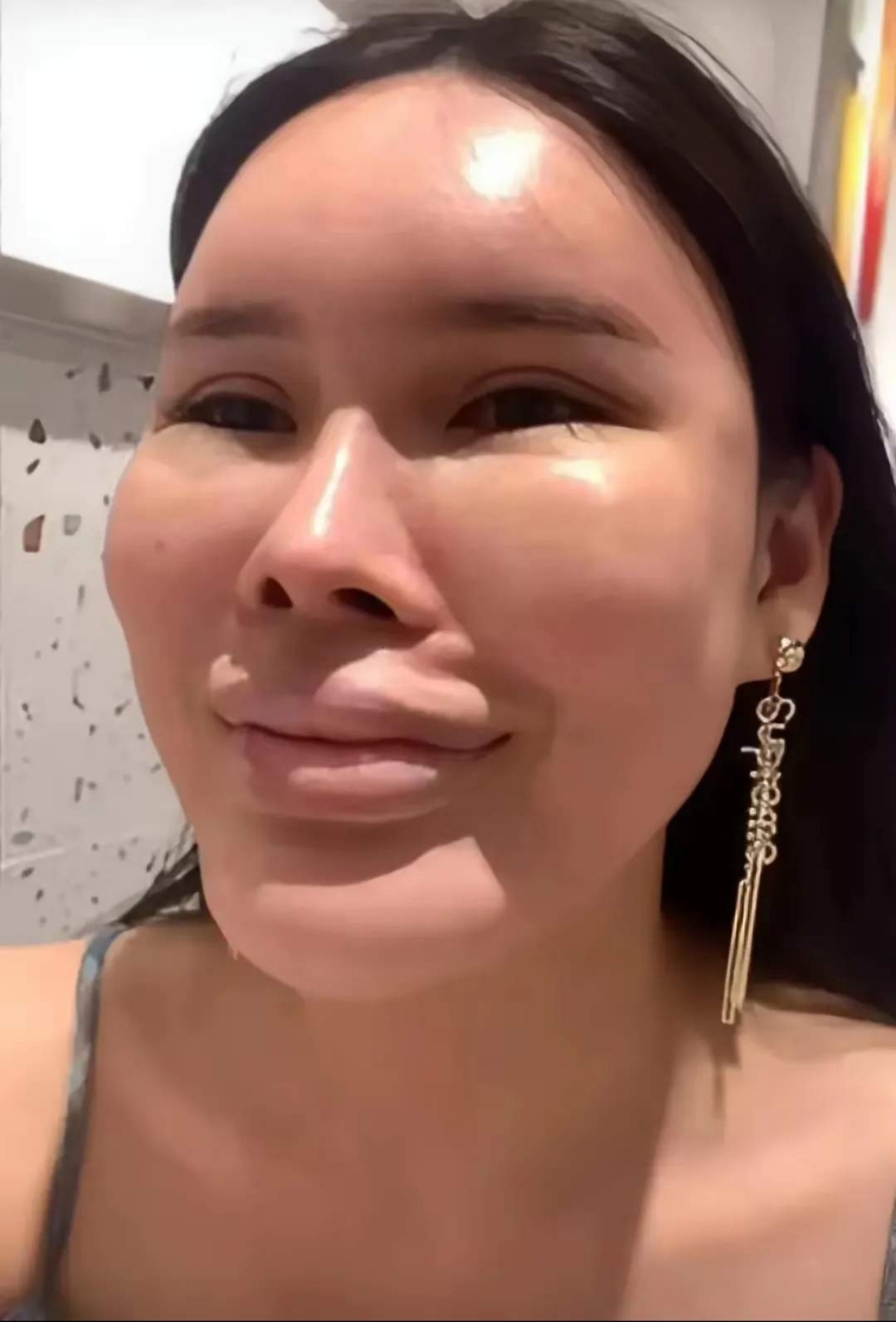 竟然不顾家人的反对,独自一人来到北京花费68万做了个全面的整容手术