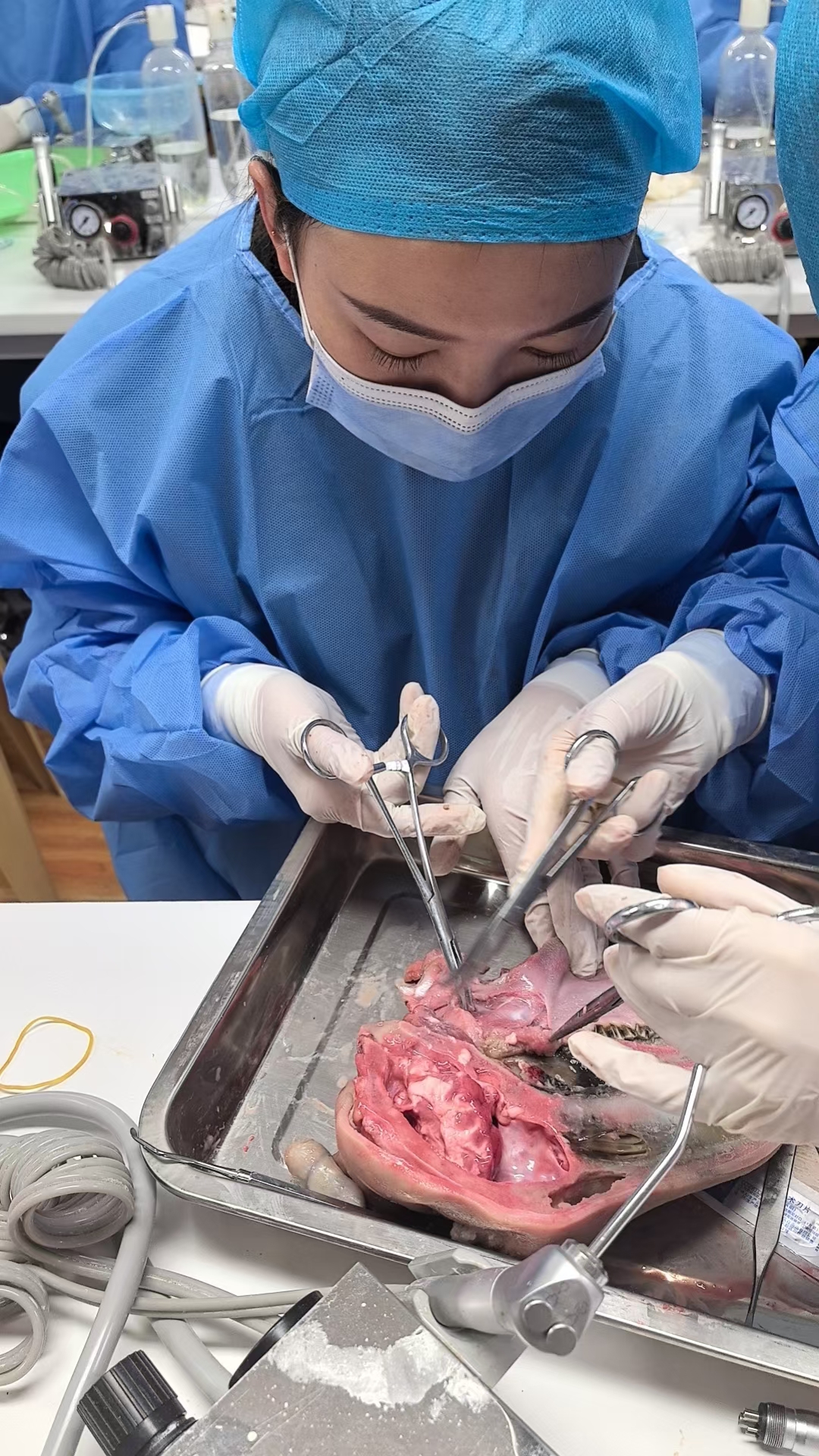 牙满分张克老师微创拔牙学习中!