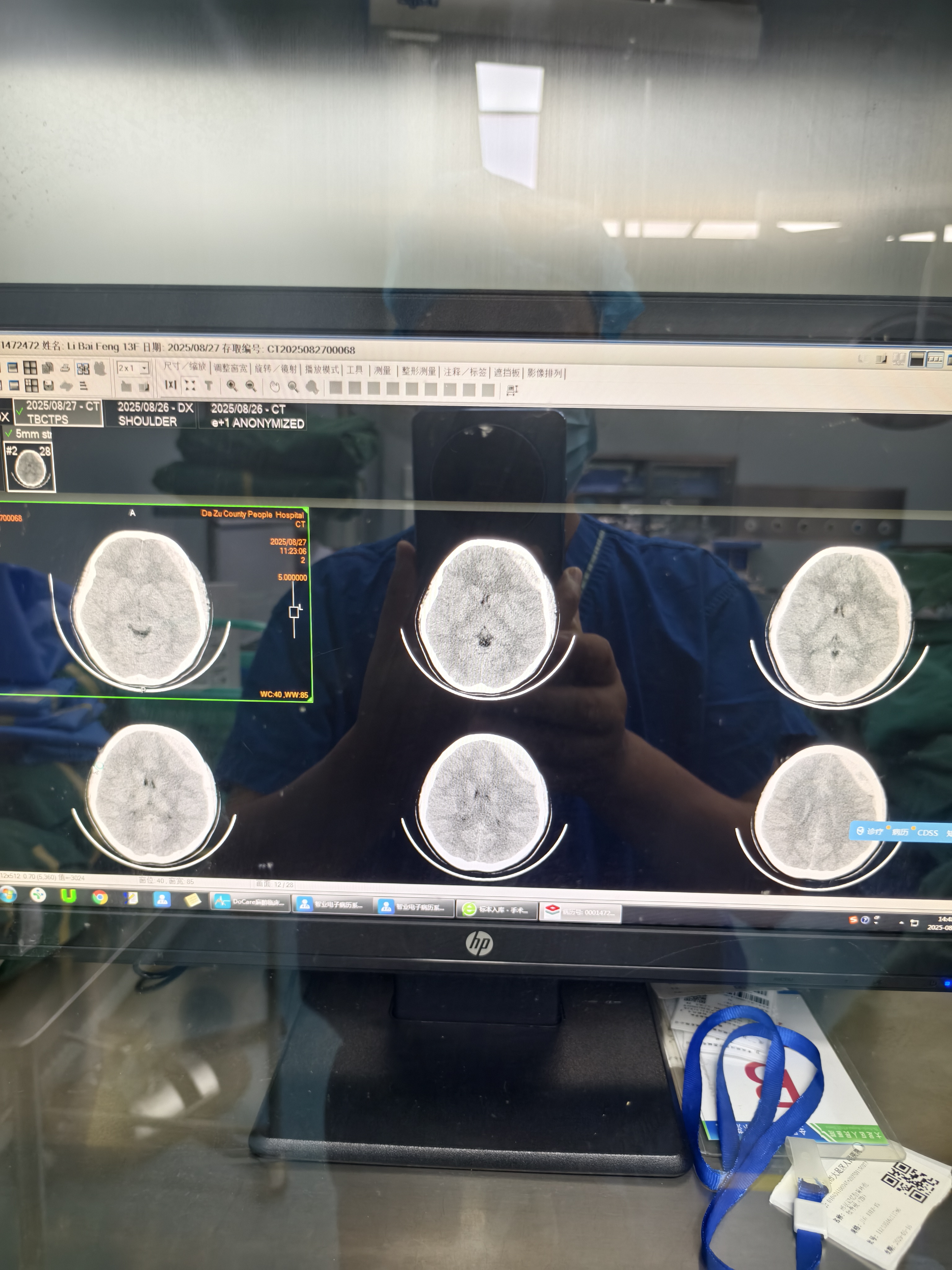 航天中心医院CT加急-航天中心医院能做核磁吗 