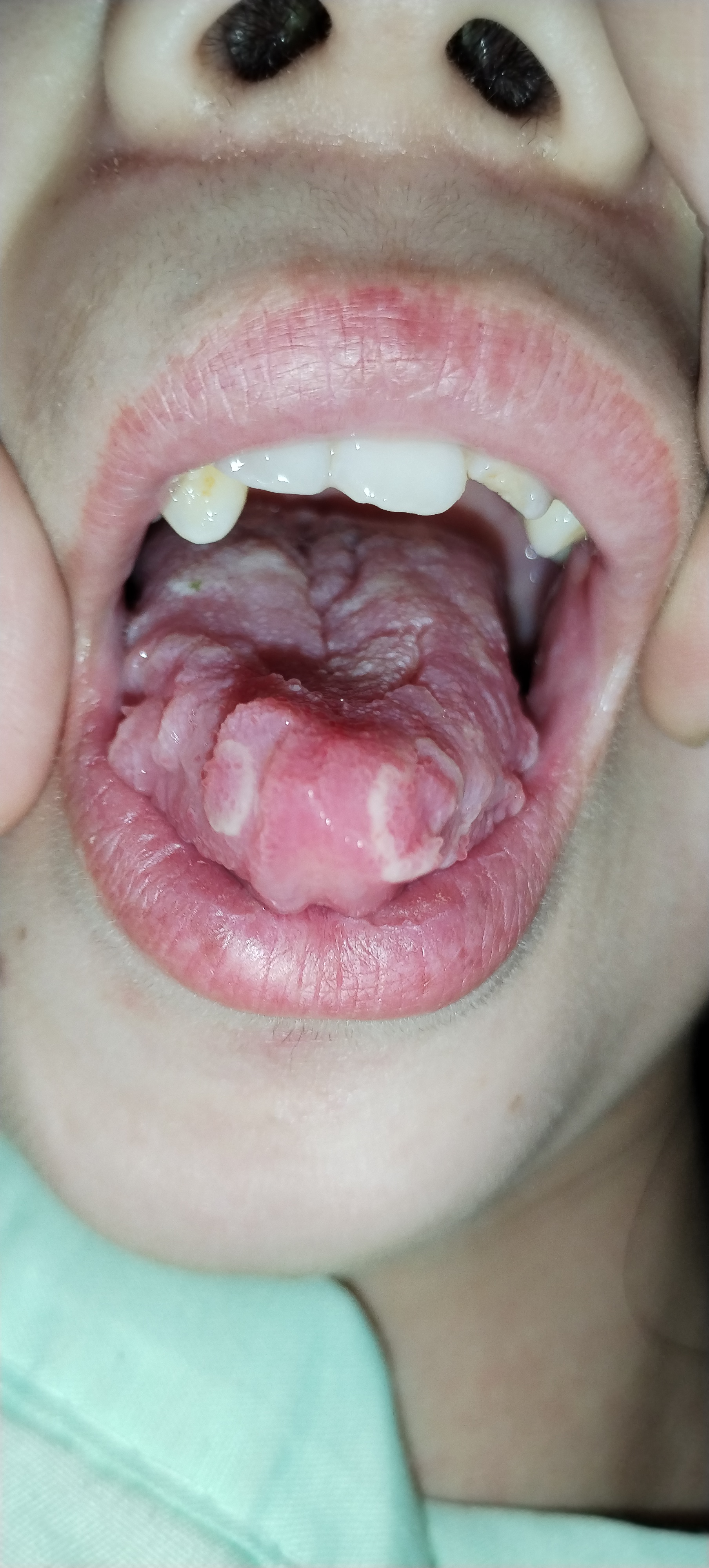 女,24岁,这是怎么回事,会不会传染,在线求解答