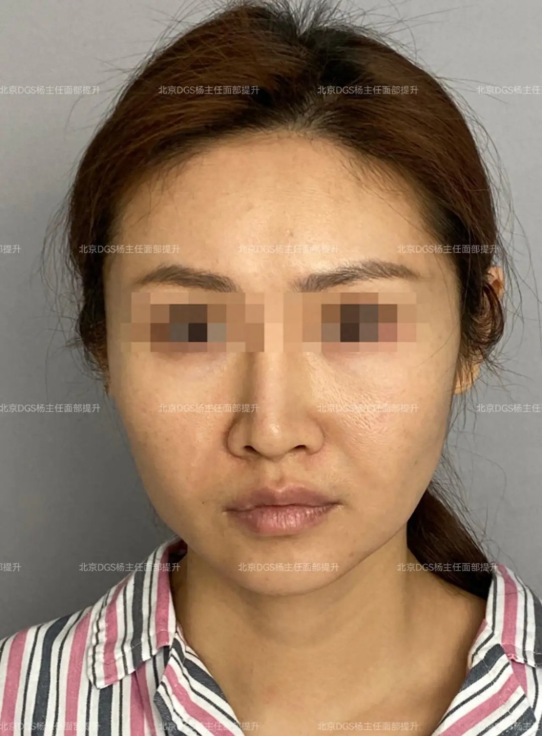 包含擅長：各種皮瓣手術、面部輪廓整形、面部器官美容整形、面部年輕化手術、乳房整形美容及外生...黃牛號販子掛號,圈子口碑最好100%有號!專業(yè)的人做專業(yè)的事的詞條
