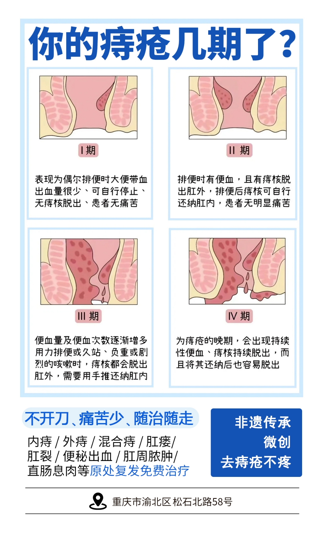 为什么会长痔疮