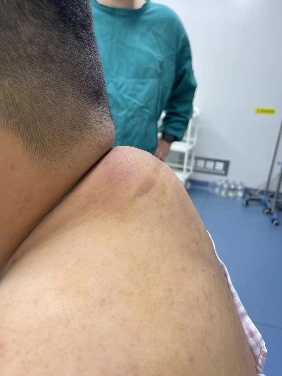 那青紫色的淤血肿块,宛如沉默的诗行,低吟着岁月的艰辛与生活的重压