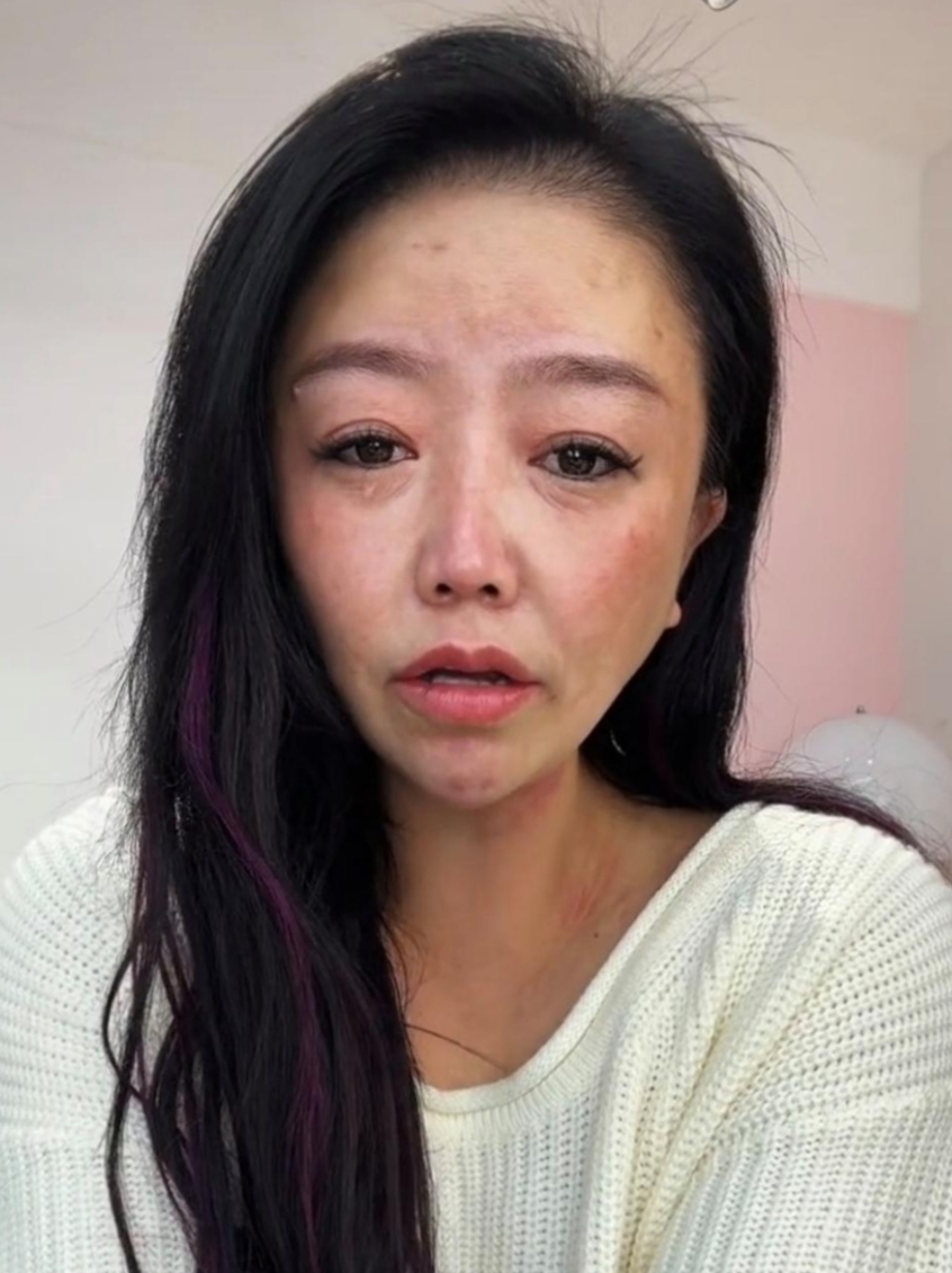 苹果姐姐曾经也有一段整容的惨痛经历