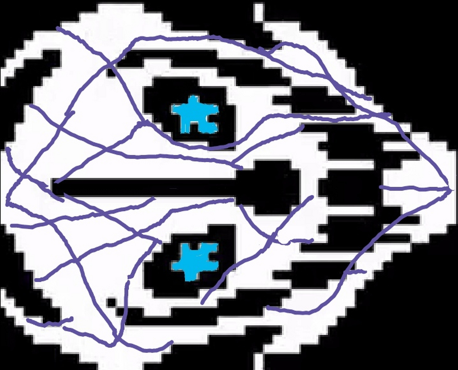 加斯特冲击波 做好了[二哈](按设子做的) 补充一下metal的一些弱点: 1