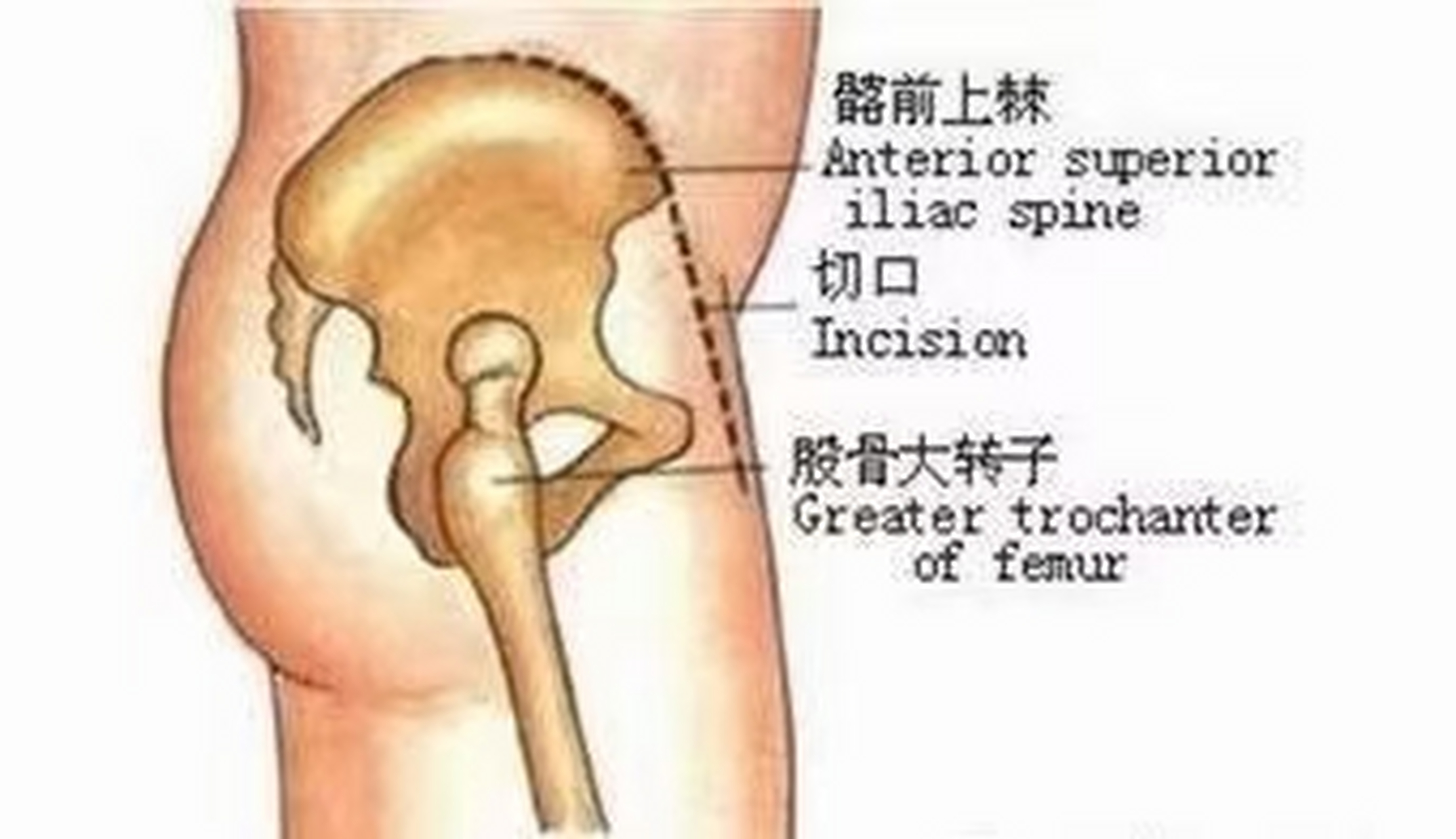 居髎 位于人体髋部,当髂前上棘与股骨大转子最凸点连线的中点处.