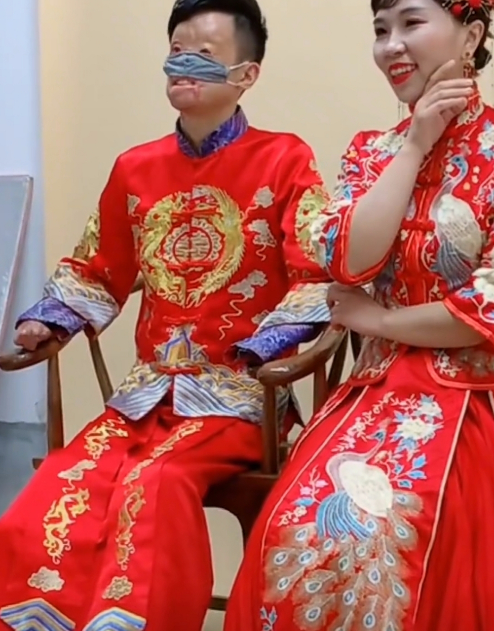 新娘不顾父母反对,毅然嫁给了烧伤消防员唐辉  他坐着轮椅,失去手臂