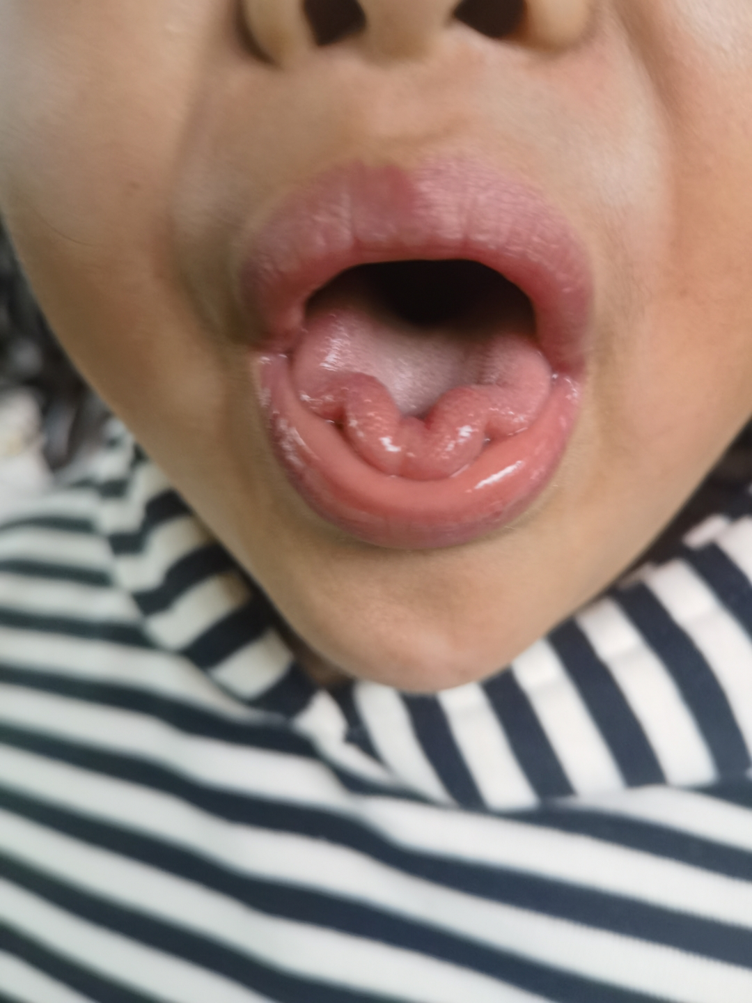 主打一个就是会莲花舌