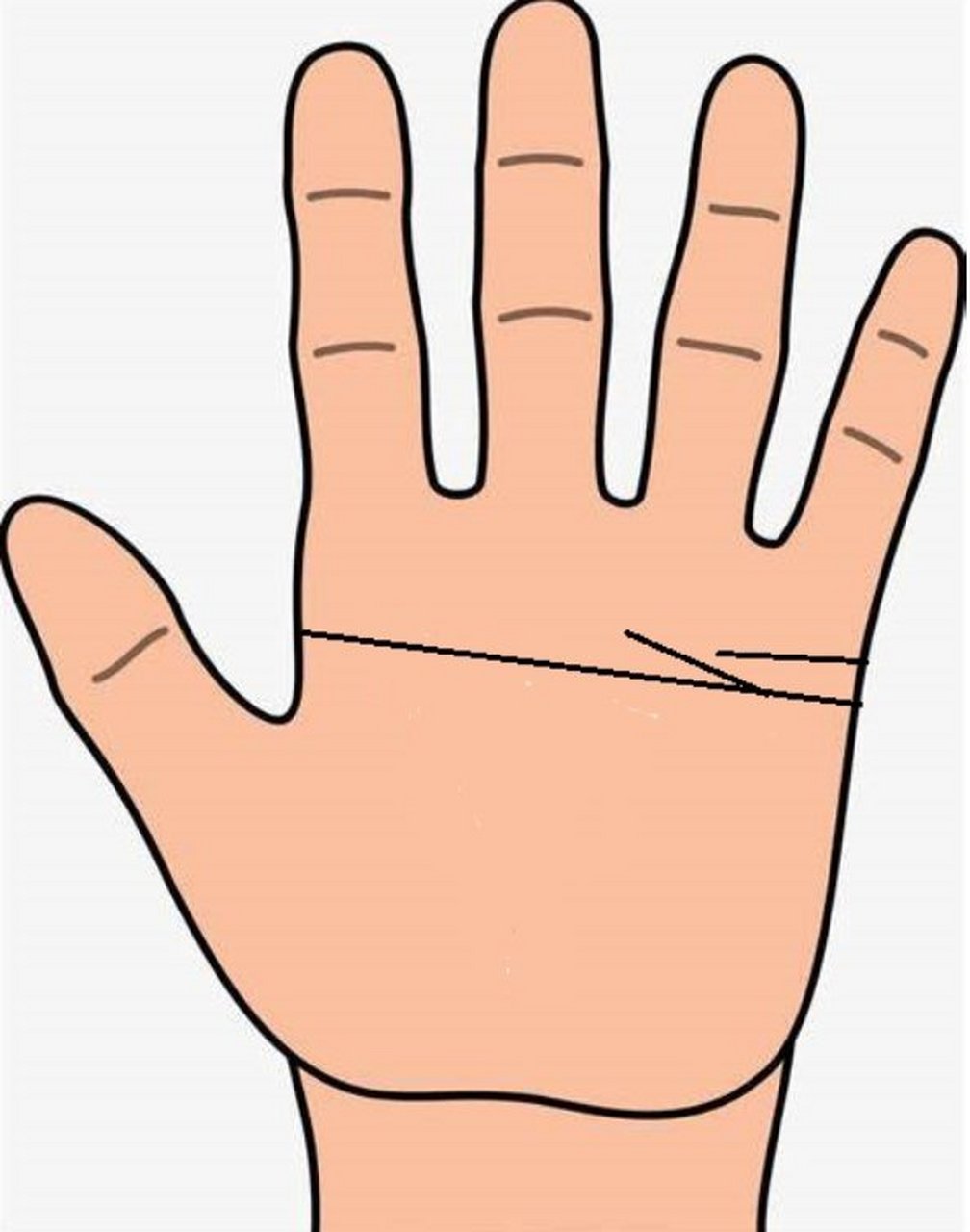 感情线型假断掌,有此掌者啊往往个性强,主意多,极度情绪化,有非凡的