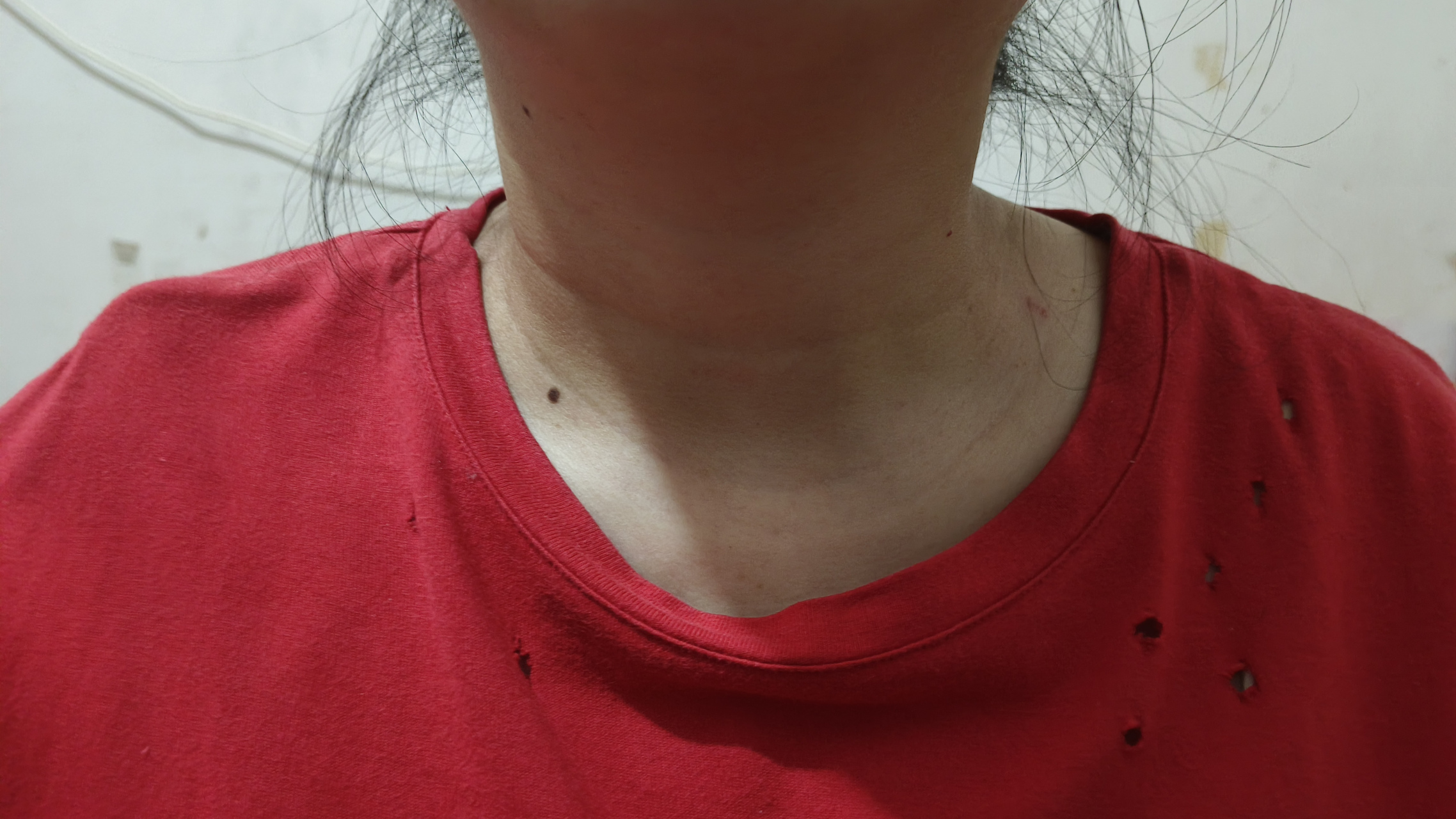 晚上照镜子突然发现自己脖子变粗了一圈,我以为是我得了甲亢.