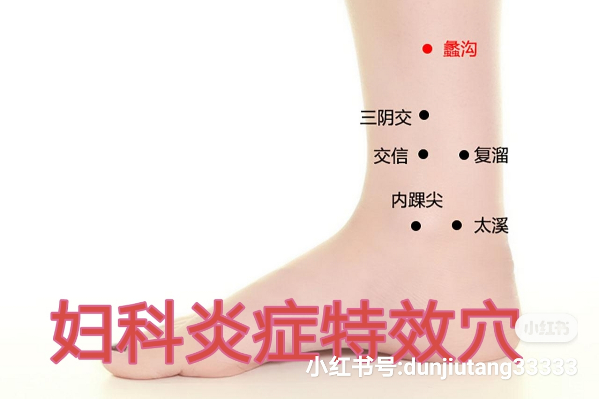 三十八,蠡沟穴——妇科炎症特效穴 【穴位概述】:蠡沟出自《黄帝内经