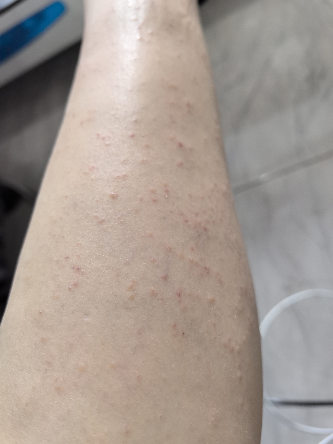 南方人冬天千万不要去北方,真的没法活,我宁可在没