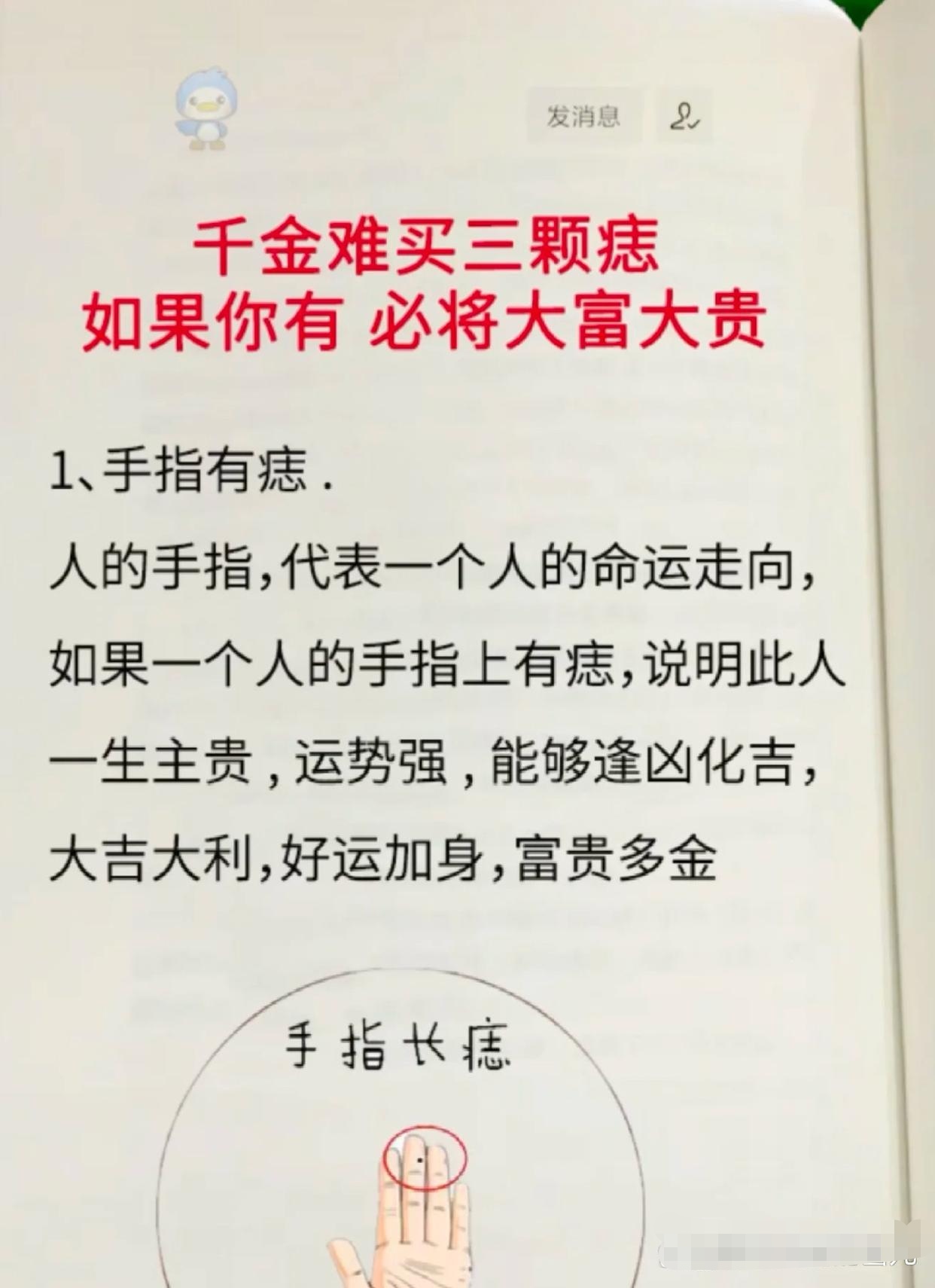 千金难买的三颗痣,非富即贵 痣长在这里,说不定你就是天生的富贵命